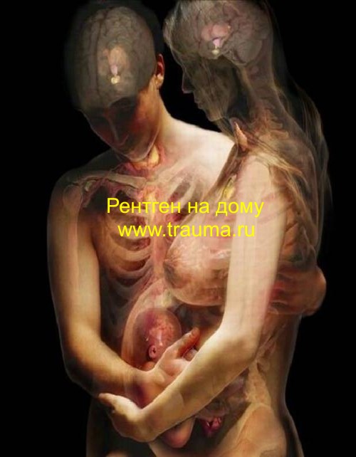 hudozh_tomogramma_men_women_baby_rentgen.jpg