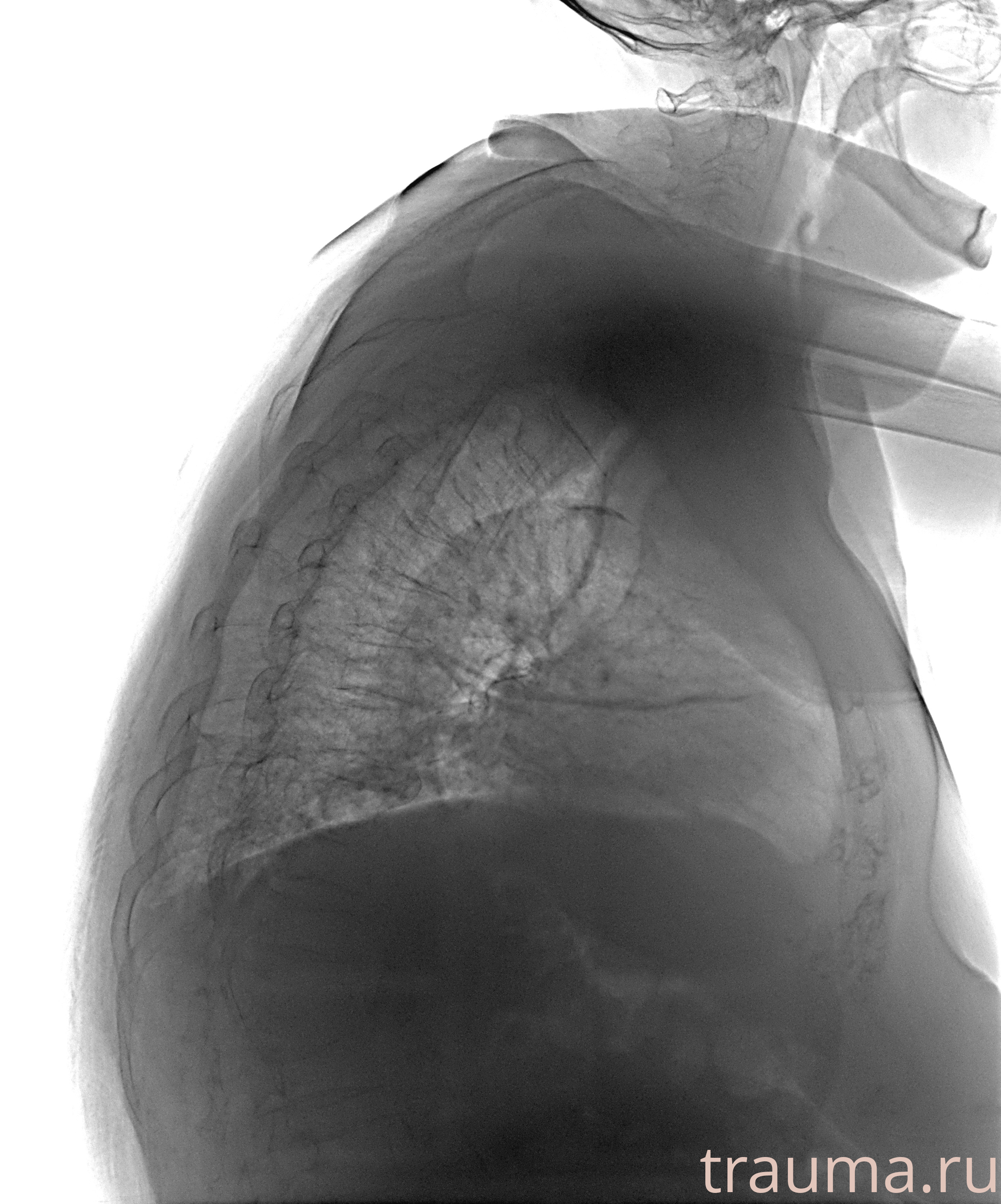 Рентген на дому: по вашему адресу приезжает врач-рентгенолог, травматолог-ортопед с мобильным рентгеновским аппаратом, проводит диагностику травмы или заболевания, делает необходимые рентгенограммы, дает рекомендации по дальнейшему лечению. Получить качественные снимки в домашних условиях возможно благодаря уникальной методике, разработанной МосРентген Центром для института  Склифосовского