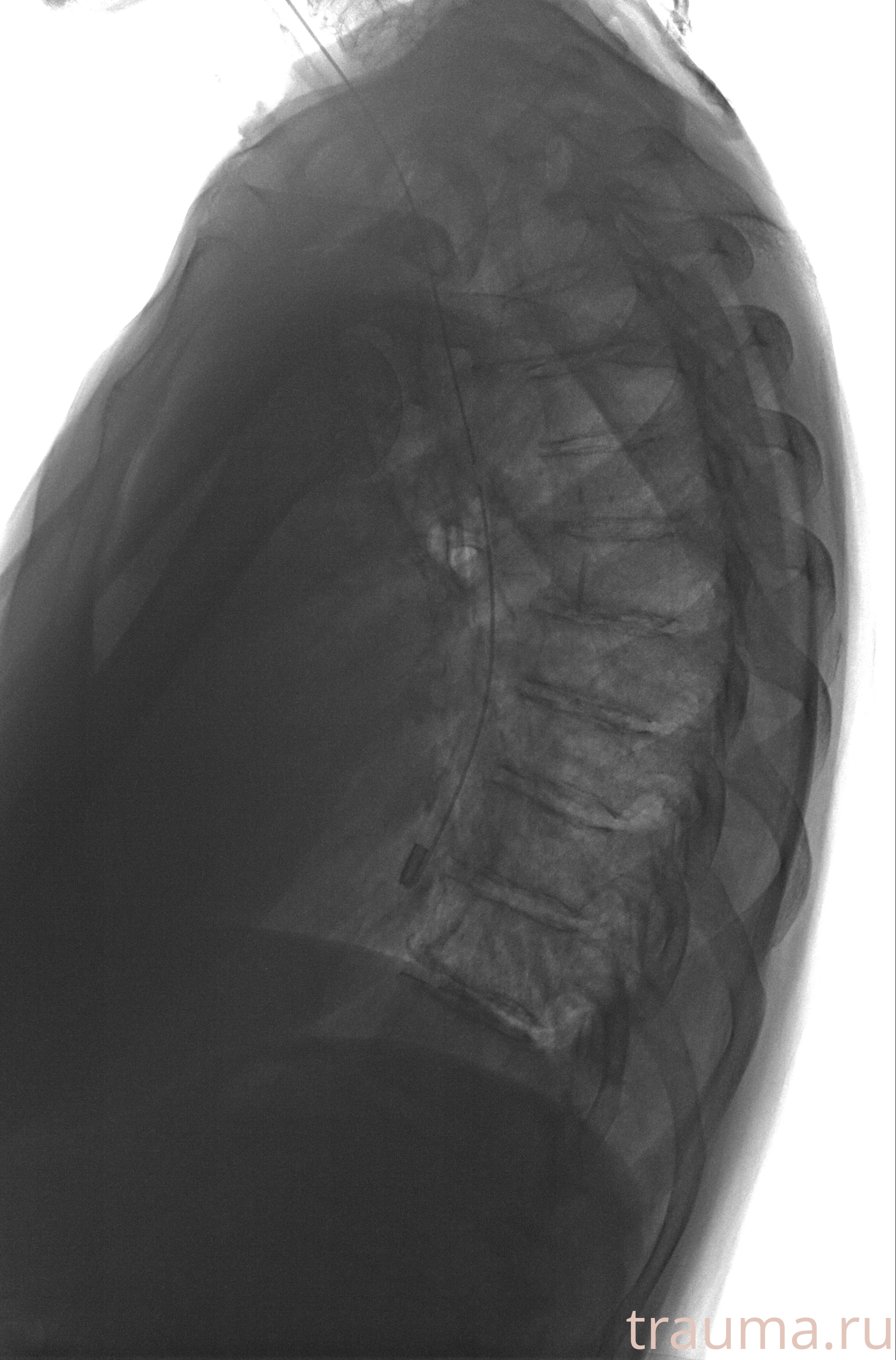 Рентген на дому: по вашему адресу приезжает врач-рентгенолог, травматолог-ортопед с мобильным рентгеновским аппаратом, проводит диагностику травмы или заболевания, делает необходимые рентгенограммы, дает рекомендации по дальнейшему лечению. Получить качественные снимки в домашних условиях возможно благодаря уникальной методике, разработанной МосРентген Центром для института  Склифосовского