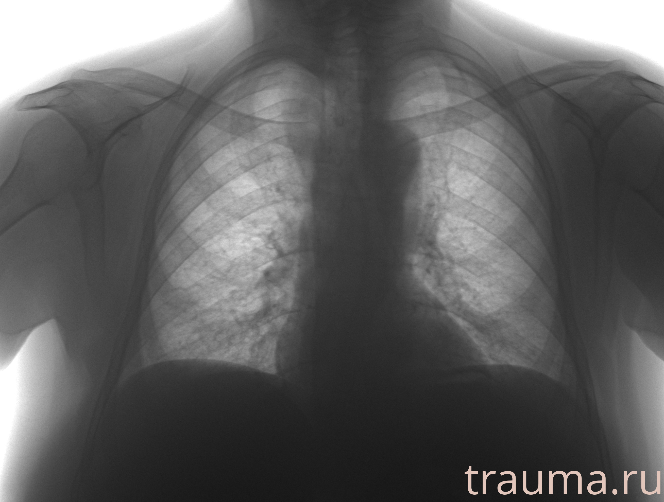 Рентген на дому: по вашему адресу приезжает врач-рентгенолог, травматолог-ортопед с мобильным рентгеновским аппаратом, проводит диагностику травмы или заболевания, делает необходимые рентгенограммы, дает рекомендации по дальнейшему лечению. Получить качественные снимки в домашних условиях возможно благодаря уникальной методике, разработанной МосРентген Центром для института  Склифосовского