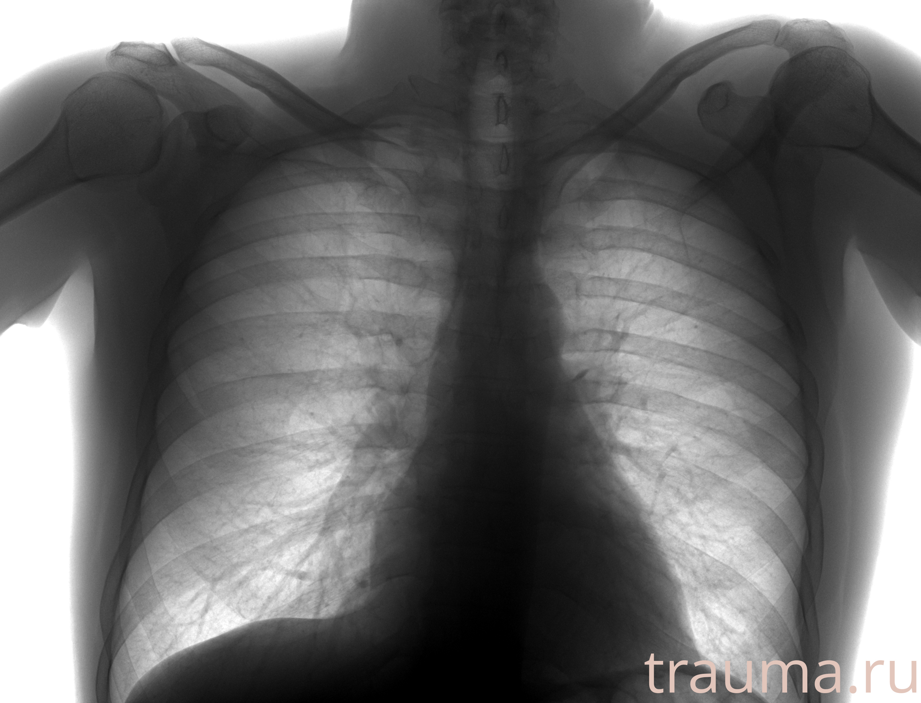 Рентген на дому: по вашему адресу приезжает врач-рентгенолог, травматолог-ортопед с мобильным рентгеновским аппаратом, проводит диагностику травмы или заболевания, делает необходимые рентгенограммы, дает рекомендации по дальнейшему лечению. Получить качественные снимки в домашних условиях возможно благодаря уникальной методике, разработанной МосРентген Центром для института  Склифосовского