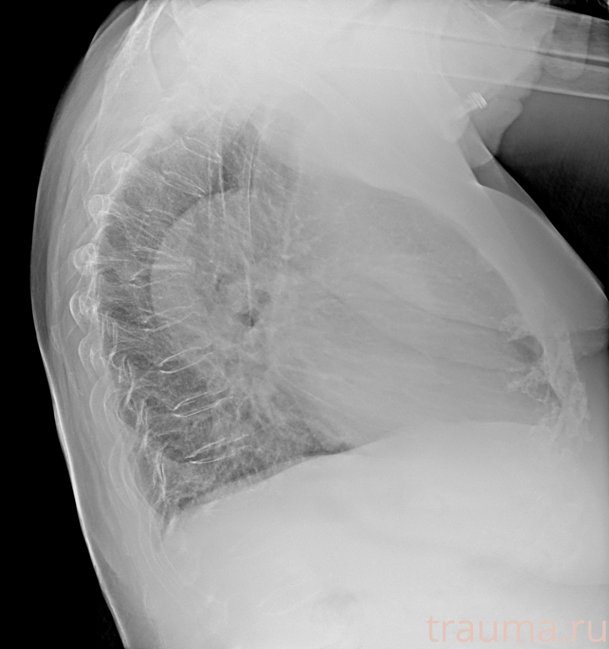 Рентген на дому: по вашему адресу приезжает врач-рентгенолог, травматолог-ортопед с мобильным рентгеновским аппаратом, проводит диагностику травмы или заболевания, делает необходимые рентгенограммы, дает рекомендации по дальнейшему лечению. Получить качественные снимки в домашних условиях возможно благодаря уникальной методике, разработанной МосРентген Центром для института  Склифосовского
