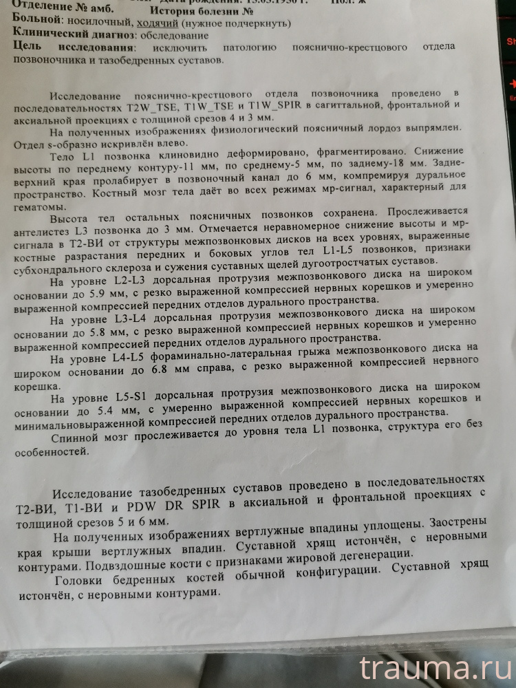 Рентген на дому: по вашему адресу приезжает врач-рентгенолог, травматолог-ортопед с мобильным рентгеновским аппаратом, проводит диагностику травмы или заболевания, делает необходимые рентгенограммы, дает рекомендации по дальнейшему лечению. Получить качественные снимки в домашних условиях возможно благодаря уникальной методике, разработанной МосРентген Центром для института  Склифосовского