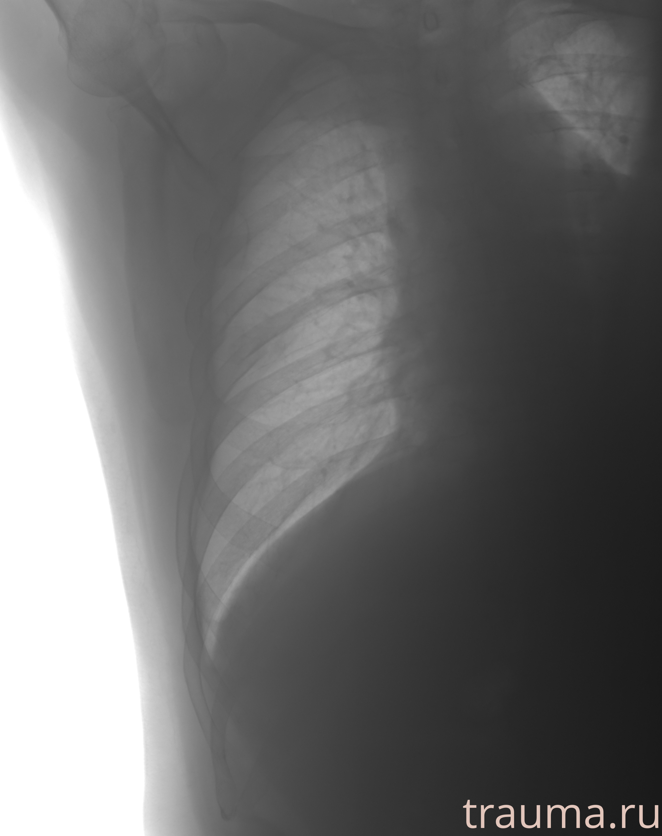 Рентген на дому: по вашему адресу приезжает врач-рентгенолог, травматолог-ортопед с мобильным рентгеновским аппаратом, проводит диагностику травмы или заболевания, делает необходимые рентгенограммы, дает рекомендации по дальнейшему лечению. Получить качественные снимки в домашних условиях возможно благодаря уникальной методике, разработанной МосРентген Центром для института  Склифосовского