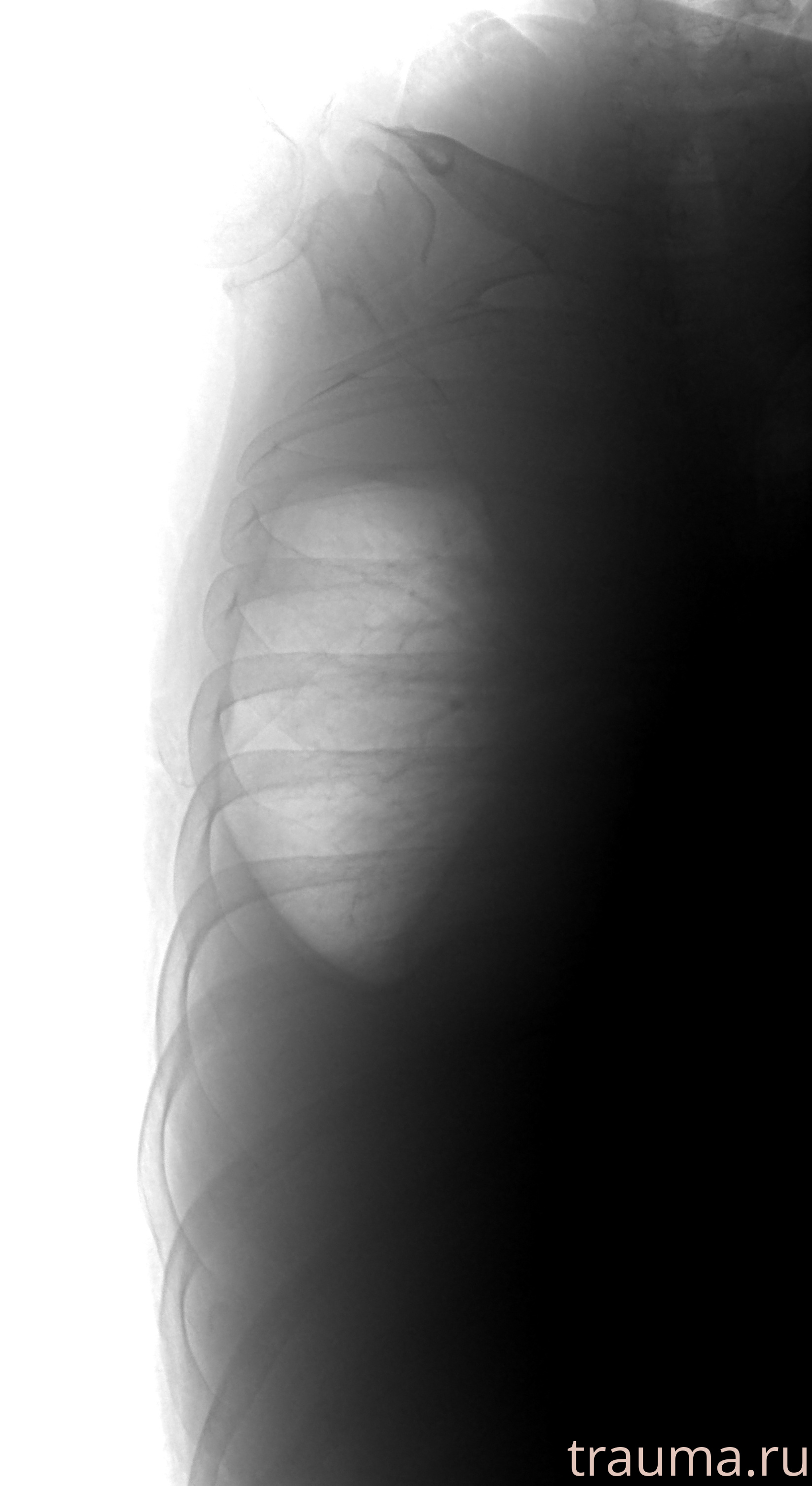 Рентген на дому: по вашему адресу приезжает врач-рентгенолог, травматолог-ортопед с мобильным рентгеновским аппаратом, проводит диагностику травмы или заболевания, делает необходимые рентгенограммы, дает рекомендации по дальнейшему лечению. Получить качественные снимки в домашних условиях возможно благодаря уникальной методике, разработанной МосРентген Центром для института  Склифосовского