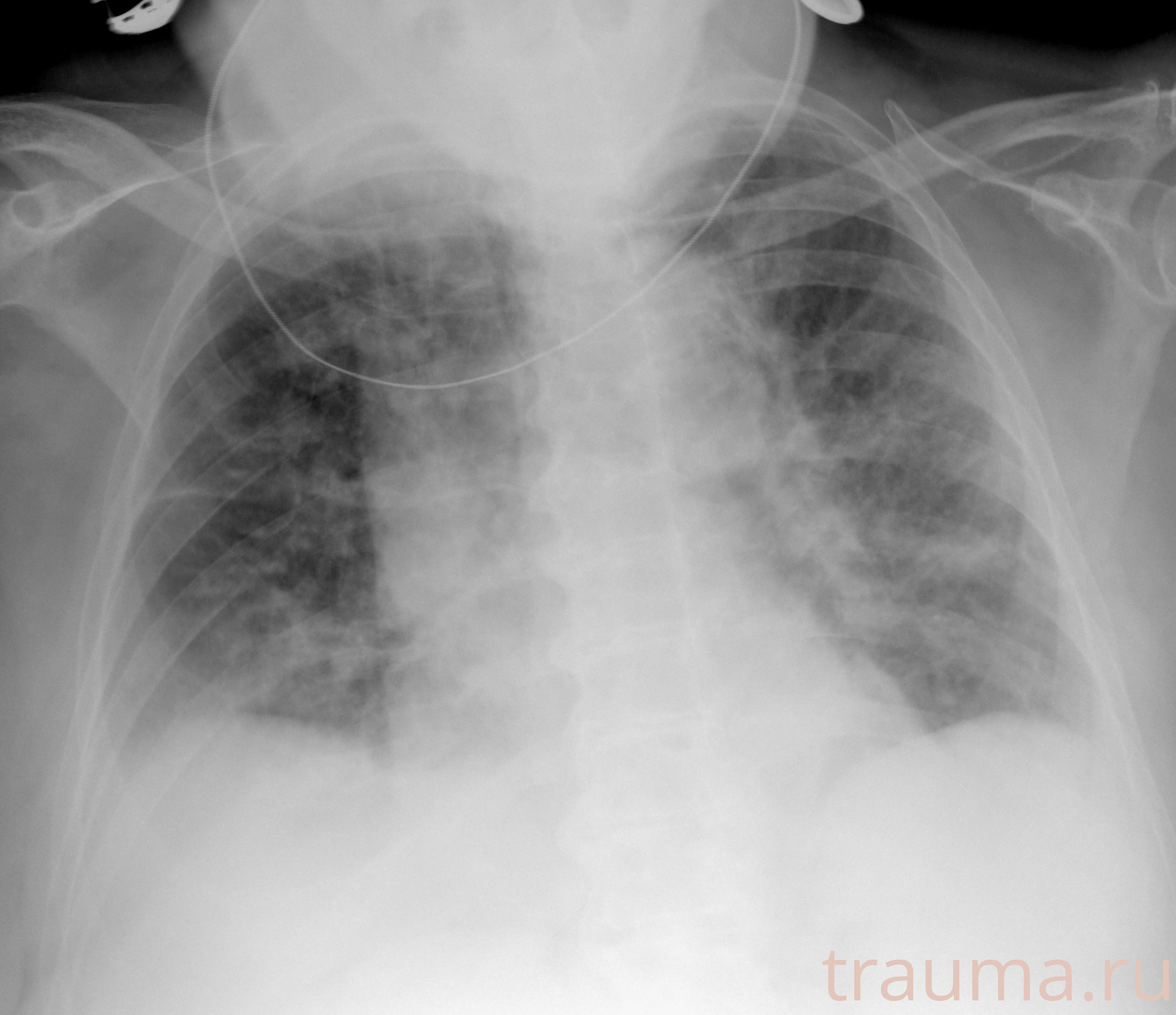 Рентген на дому: по вашему адресу приезжает врач-рентгенолог, травматолог-ортопед с мобильным рентгеновским аппаратом, проводит диагностику травмы или заболевания, делает необходимые рентгенограммы, дает рекомендации по дальнейшему лечению. Получить качественные снимки в домашних условиях возможно благодаря уникальной методике, разработанной МосРентген Центром для института  Склифосовского