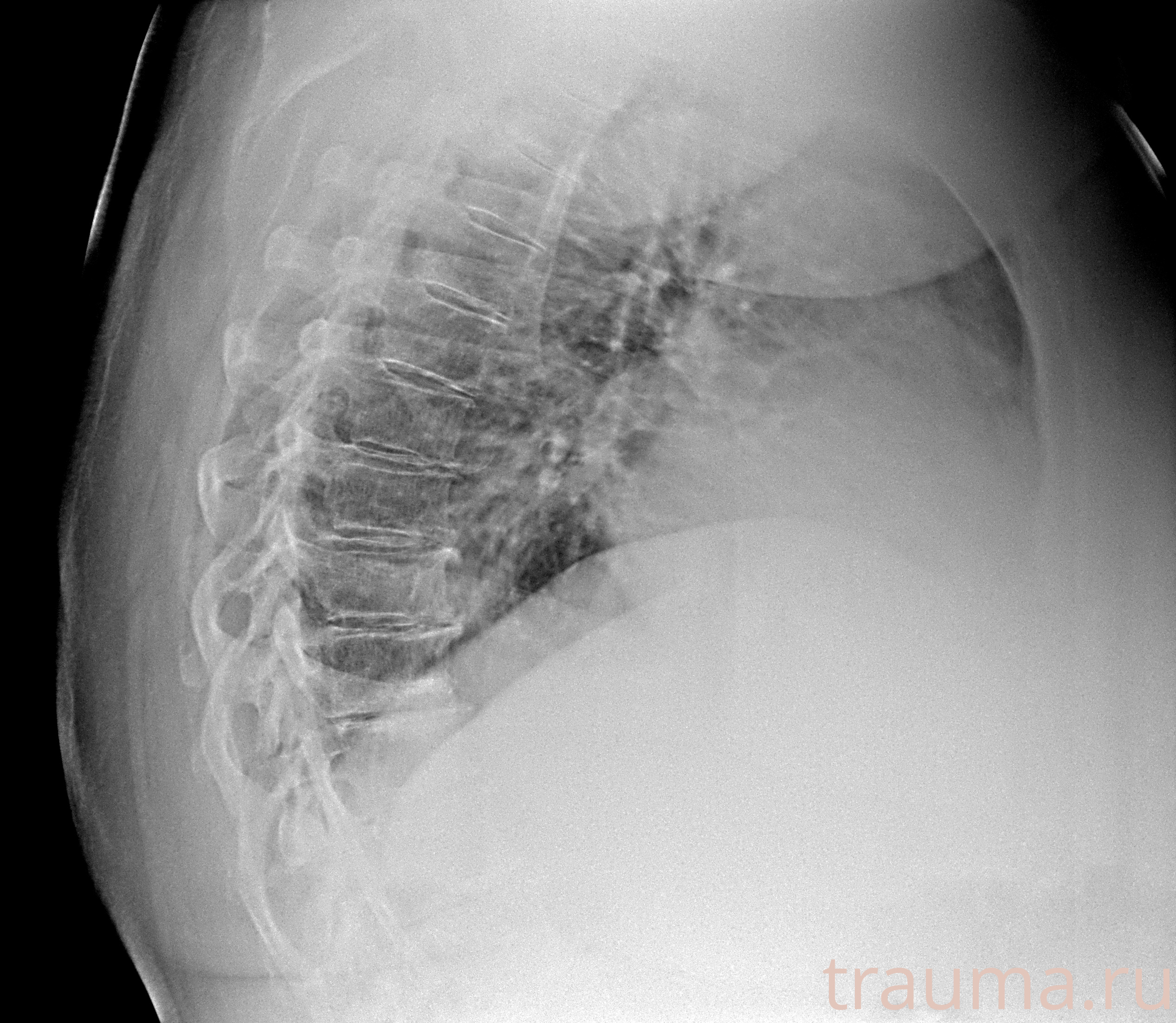 Рентген на дому: по вашему адресу приезжает врач-рентгенолог, травматолог-ортопед с мобильным рентгеновским аппаратом, проводит диагностику травмы или заболевания, делает необходимые рентгенограммы, дает рекомендации по дальнейшему лечению. Получить качественные снимки в домашних условиях возможно благодаря уникальной методике, разработанной МосРентген Центром для института  Склифосовского