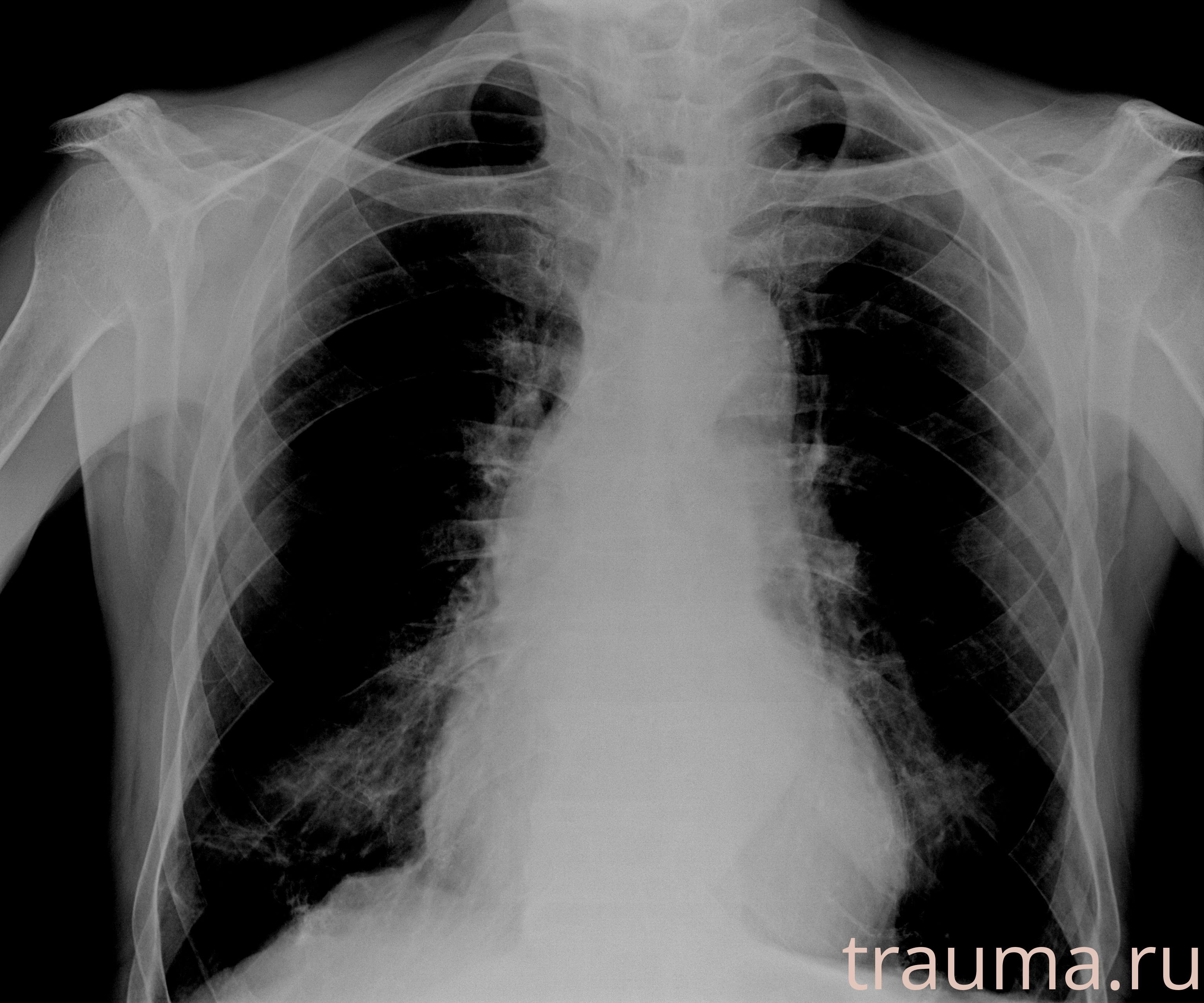Рентген на дому: по вашему адресу приезжает врач-рентгенолог, травматолог-ортопед с мобильным рентгеновским аппаратом, проводит диагностику травмы или заболевания, делает необходимые рентгенограммы, дает рекомендации по дальнейшему лечению. Получить качественные снимки в домашних условиях возможно благодаря уникальной методике, разработанной МосРентген Центром для института  Склифосовского