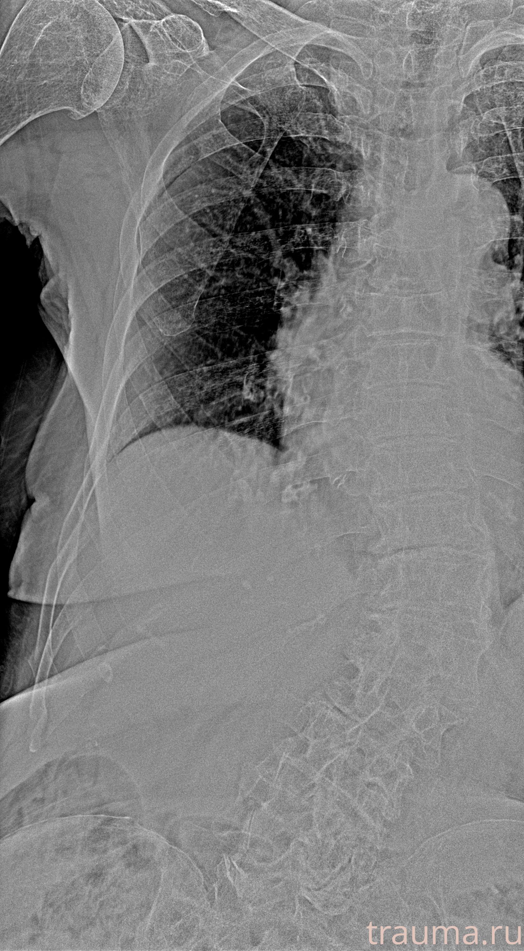 Рентген на дому: по вашему адресу приезжает врач-рентгенолог, травматолог-ортопед с мобильным рентгеновским аппаратом, проводит диагностику травмы или заболевания, делает необходимые рентгенограммы, дает рекомендации по дальнейшему лечению. Получить качественные снимки в домашних условиях возможно благодаря уникальной методике, разработанной МосРентген Центром для института  Склифосовского