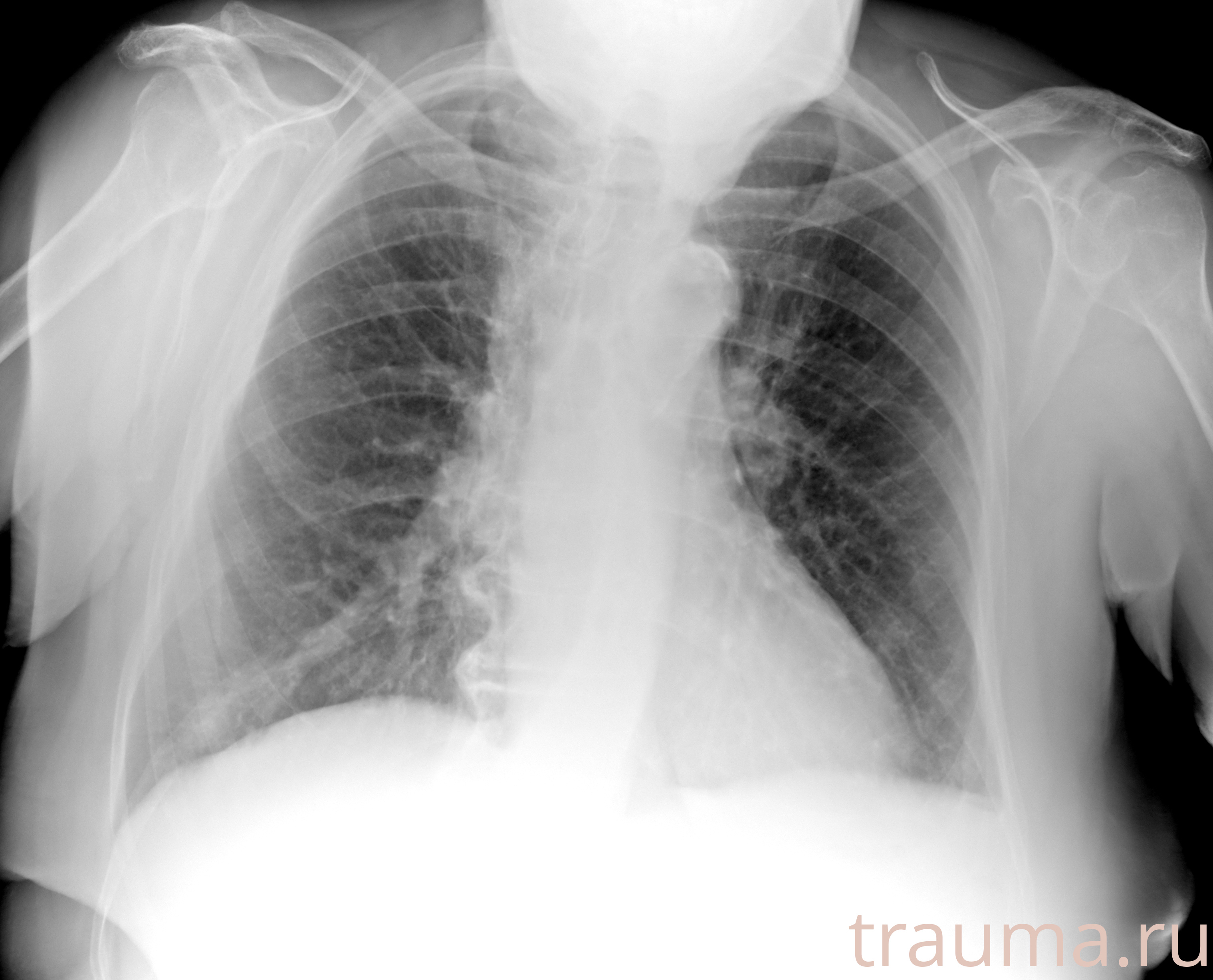 Рентген на дому: по вашему адресу приезжает врач-рентгенолог, травматолог-ортопед с мобильным рентгеновским аппаратом, проводит диагностику травмы или заболевания, делает необходимые рентгенограммы, дает рекомендации по дальнейшему лечению. Получить качественные снимки в домашних условиях возможно благодаря уникальной методике, разработанной МосРентген Центром для института  Склифосовского