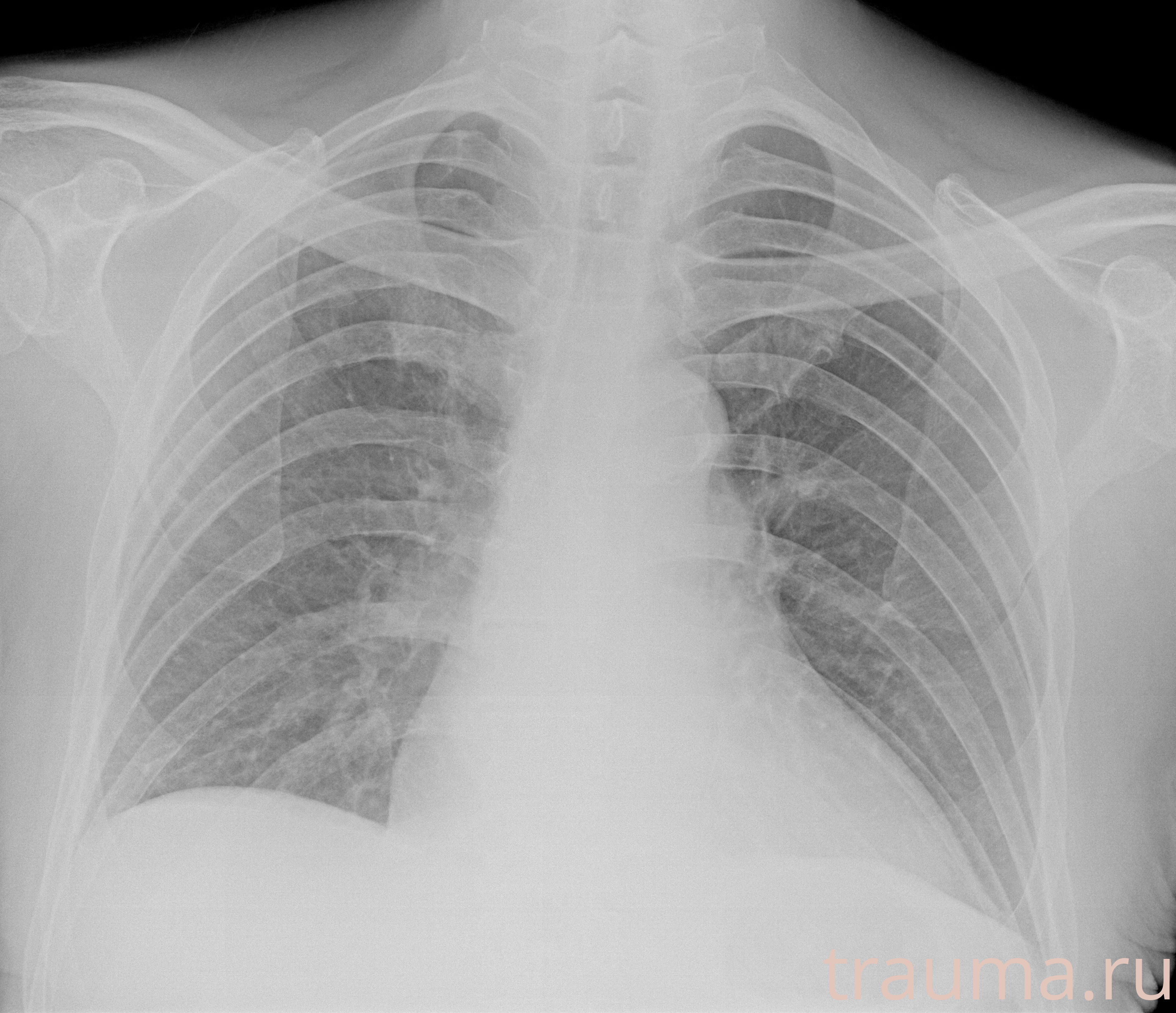 Рентген на дому: по вашему адресу приезжает врач-рентгенолог, травматолог-ортопед с мобильным рентгеновским аппаратом, проводит диагностику травмы или заболевания, делает необходимые рентгенограммы, дает рекомендации по дальнейшему лечению. Получить качественные снимки в домашних условиях возможно благодаря уникальной методике, разработанной МосРентген Центром для института  Склифосовского