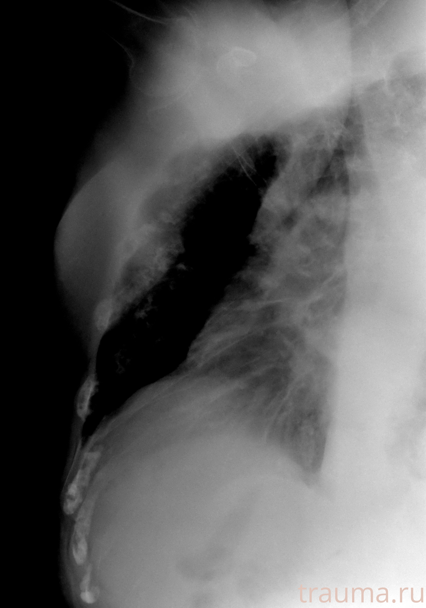 Рентген на дому: по вашему адресу приезжает врач-рентгенолог, травматолог-ортопед с мобильным рентгеновским аппаратом, проводит диагностику травмы или заболевания, делает необходимые рентгенограммы, дает рекомендации по дальнейшему лечению. Получить качественные снимки в домашних условиях возможно благодаря уникальной методике, разработанной МосРентген Центром для института  Склифосовского