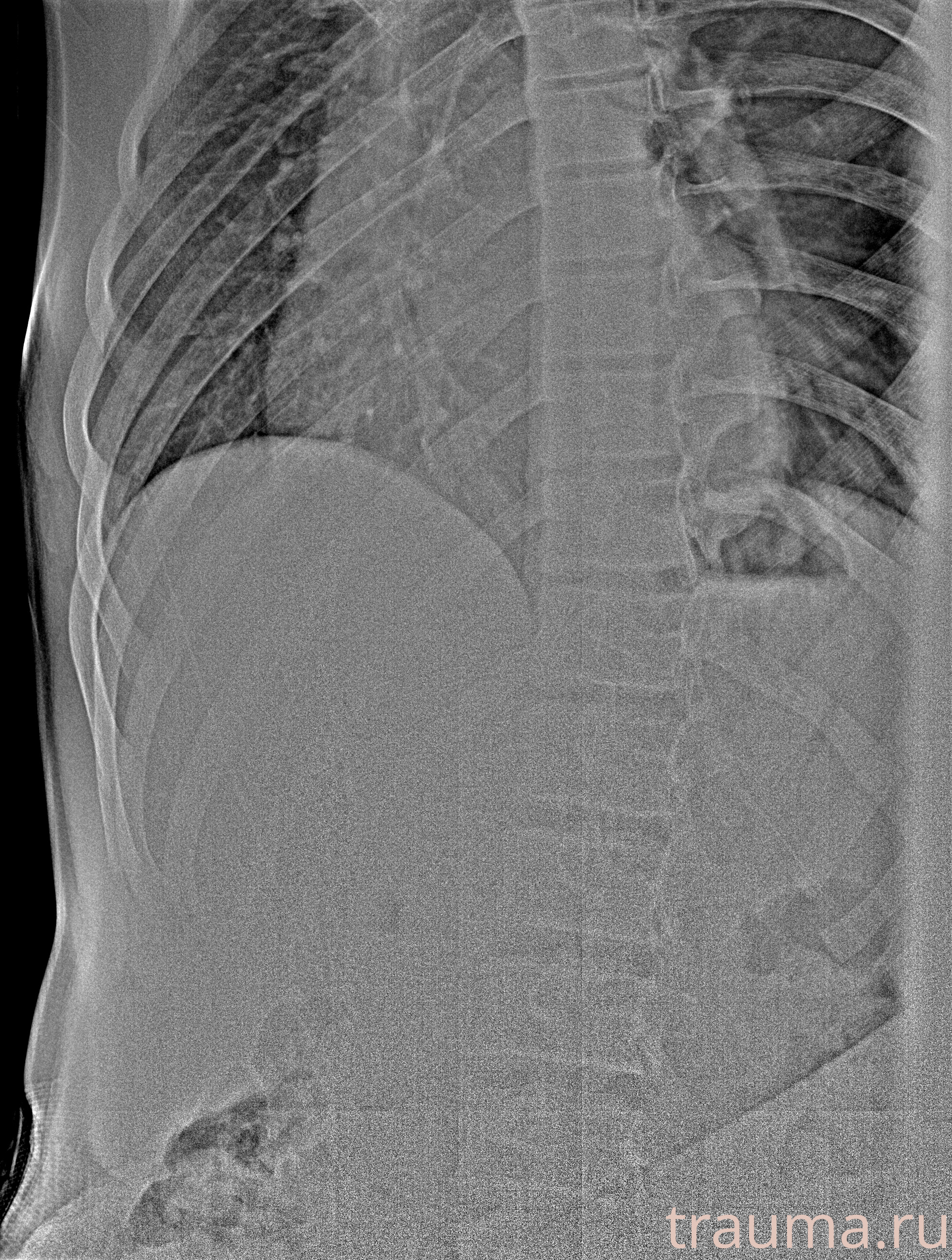 Рентген на дому: по вашему адресу приезжает врач-рентгенолог, травматолог-ортопед с мобильным рентгеновским аппаратом, проводит диагностику травмы или заболевания, делает необходимые рентгенограммы, дает рекомендации по дальнейшему лечению. Получить качественные снимки в домашних условиях возможно благодаря уникальной методике, разработанной МосРентген Центром для института  Склифосовского