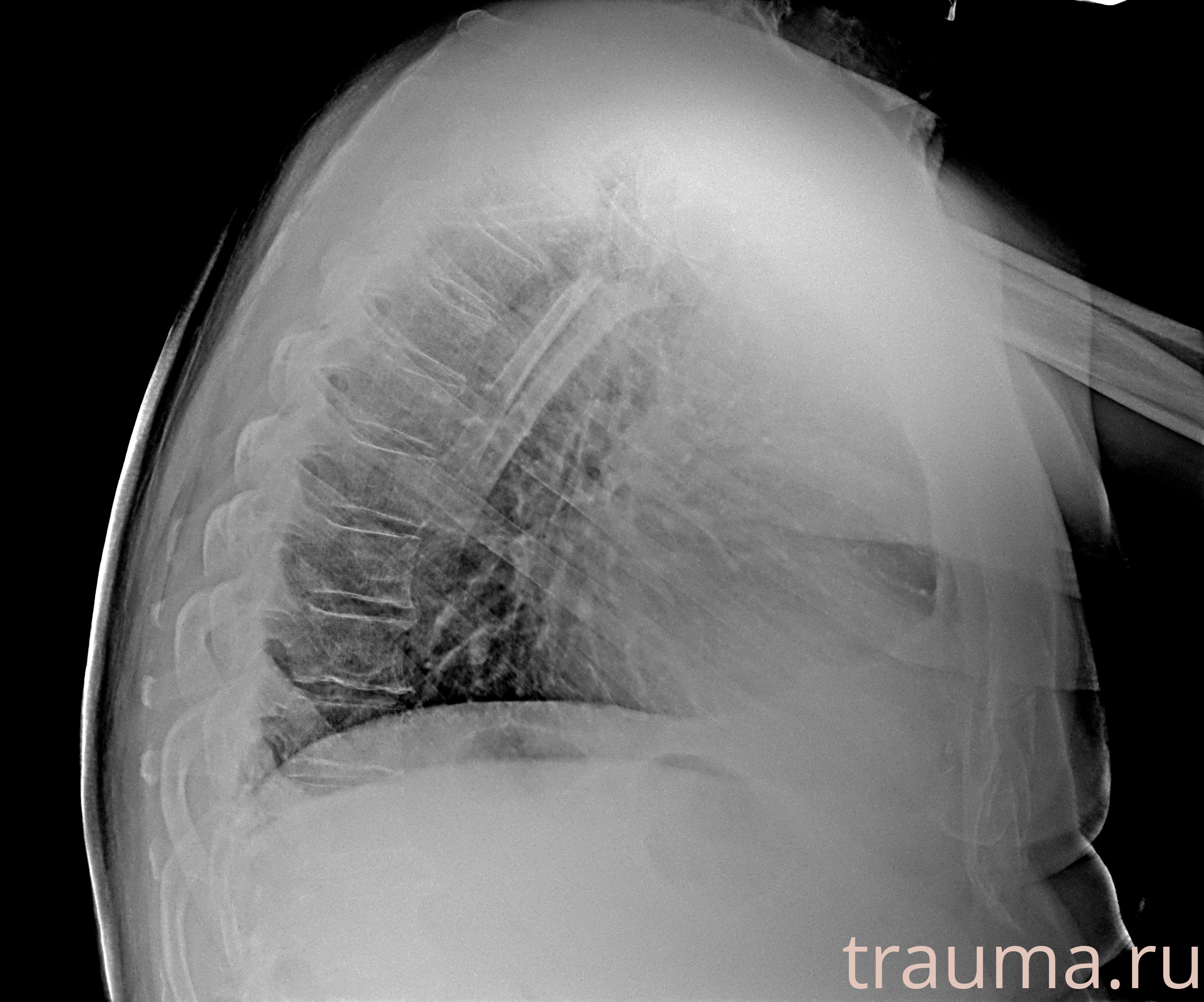Рентген на дому: по вашему адресу приезжает врач-рентгенолог, травматолог-ортопед с мобильным рентгеновским аппаратом, проводит диагностику травмы или заболевания, делает необходимые рентгенограммы, дает рекомендации по дальнейшему лечению. Получить качественные снимки в домашних условиях возможно благодаря уникальной методике, разработанной МосРентген Центром для института  Склифосовского