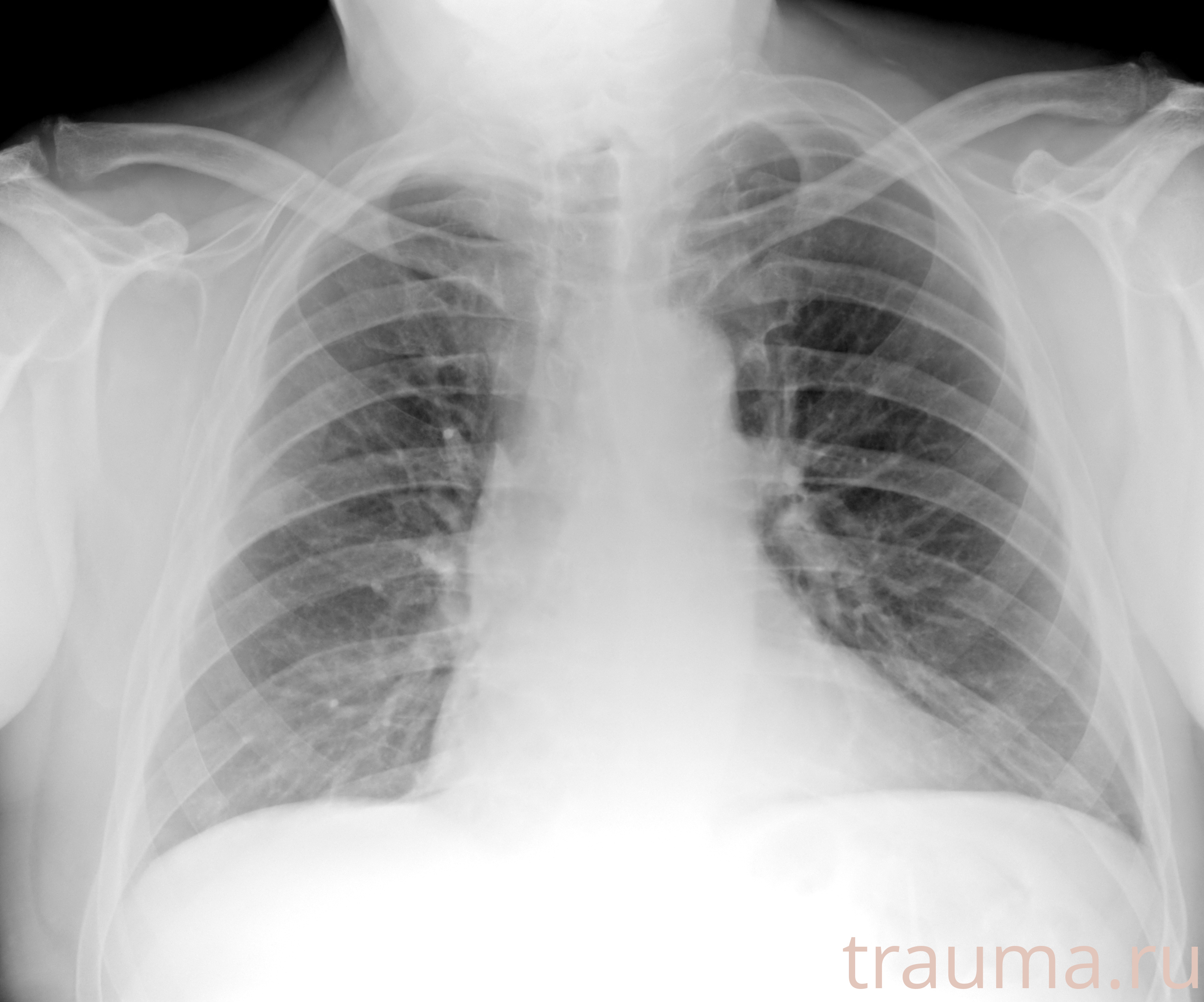 Рентген на дому: по вашему адресу приезжает врач-рентгенолог, травматолог-ортопед с мобильным рентгеновским аппаратом, проводит диагностику травмы или заболевания, делает необходимые рентгенограммы, дает рекомендации по дальнейшему лечению. Получить качественные снимки в домашних условиях возможно благодаря уникальной методике, разработанной МосРентген Центром для института  Склифосовского