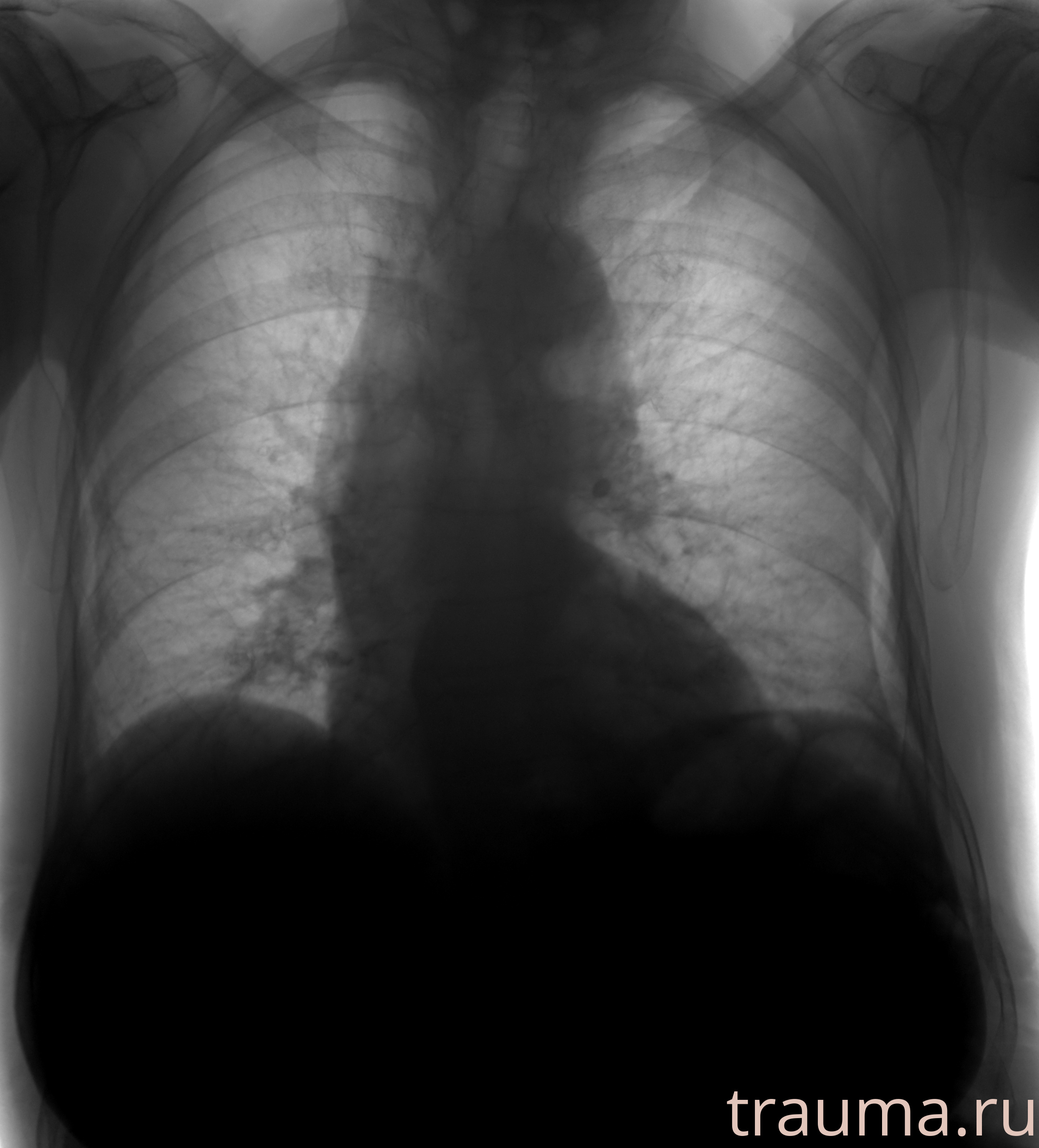 Рентген на дому: по вашему адресу приезжает врач-рентгенолог, травматолог-ортопед с мобильным рентгеновским аппаратом, проводит диагностику травмы или заболевания, делает необходимые рентгенограммы, дает рекомендации по дальнейшему лечению. Получить качественные снимки в домашних условиях возможно благодаря уникальной методике, разработанной МосРентген Центром для института  Склифосовского