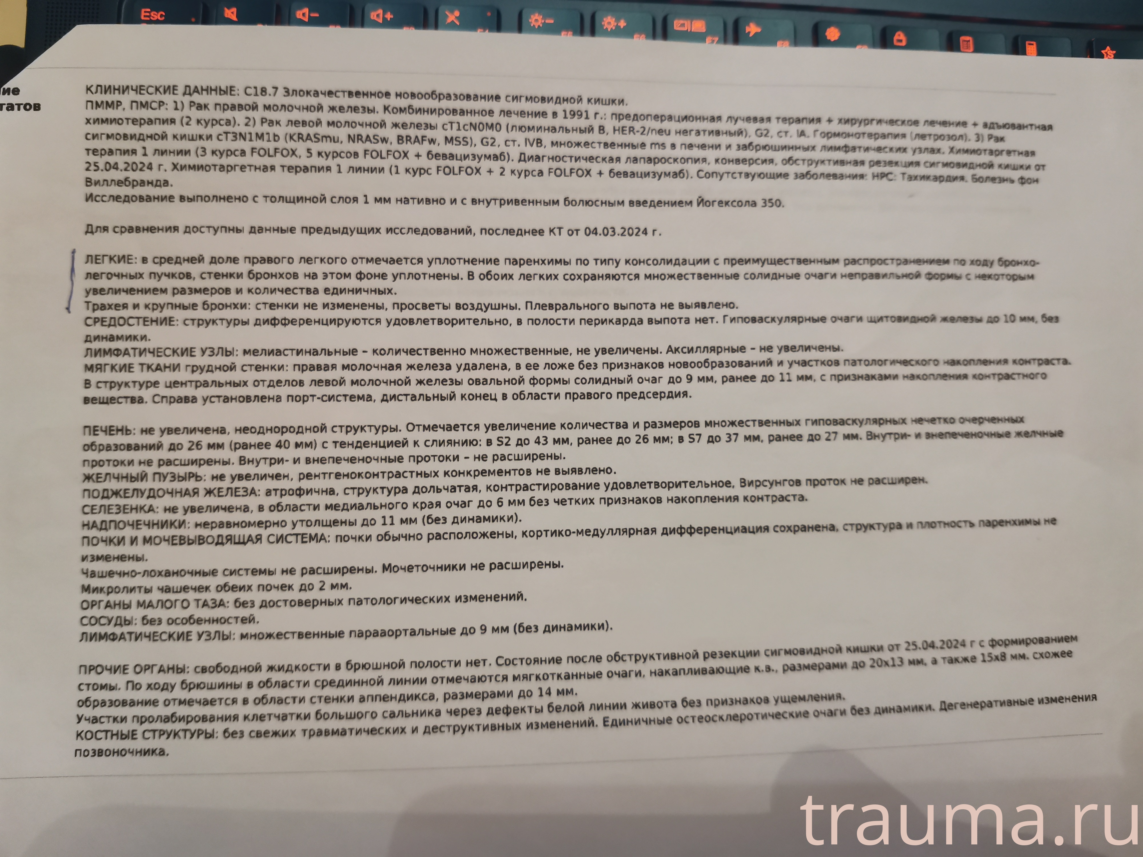 Рентген на дому: по вашему адресу приезжает врач-рентгенолог, травматолог-ортопед с мобильным рентгеновским аппаратом, проводит диагностику травмы или заболевания, делает необходимые рентгенограммы, дает рекомендации по дальнейшему лечению. Получить качественные снимки в домашних условиях возможно благодаря уникальной методике, разработанной МосРентген Центром для института  Склифосовского