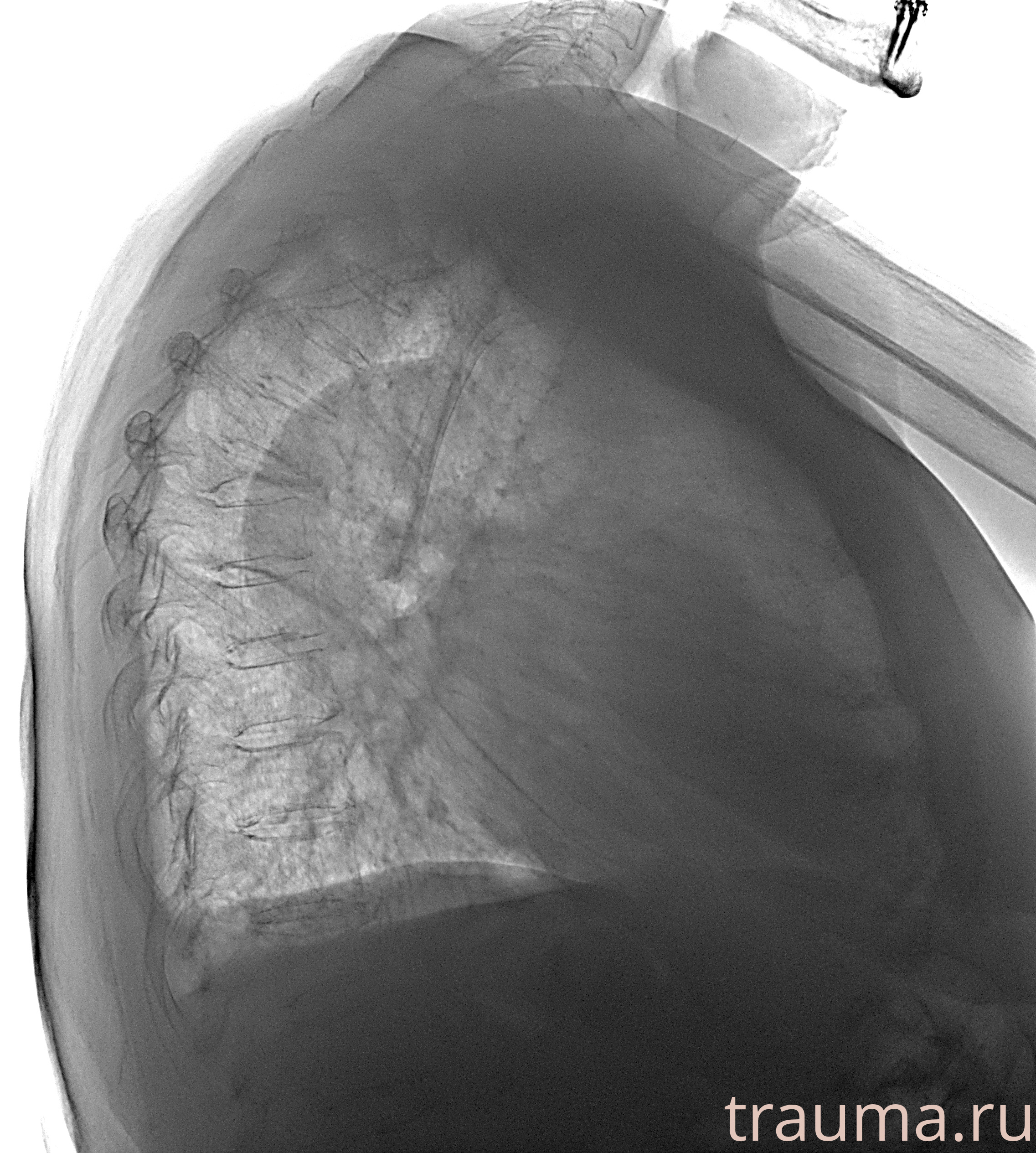 Рентген на дому: по вашему адресу приезжает врач-рентгенолог, травматолог-ортопед с мобильным рентгеновским аппаратом, проводит диагностику травмы или заболевания, делает необходимые рентгенограммы, дает рекомендации по дальнейшему лечению. Получить качественные снимки в домашних условиях возможно благодаря уникальной методике, разработанной МосРентген Центром для института  Склифосовского