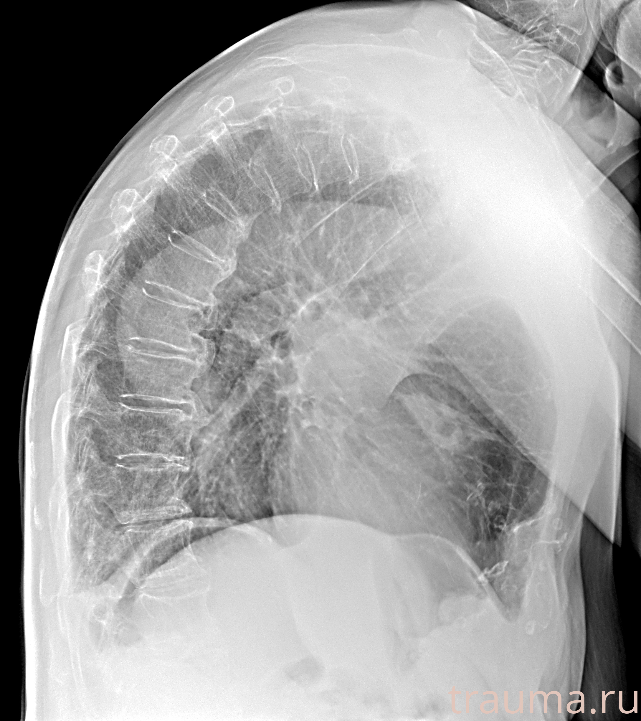 Рентген на дому: по вашему адресу приезжает врач-рентгенолог, травматолог-ортопед с мобильным рентгеновским аппаратом, проводит диагностику травмы или заболевания, делает необходимые рентгенограммы, дает рекомендации по дальнейшему лечению. Получить качественные снимки в домашних условиях возможно благодаря уникальной методике, разработанной МосРентген Центром для института  Склифосовского