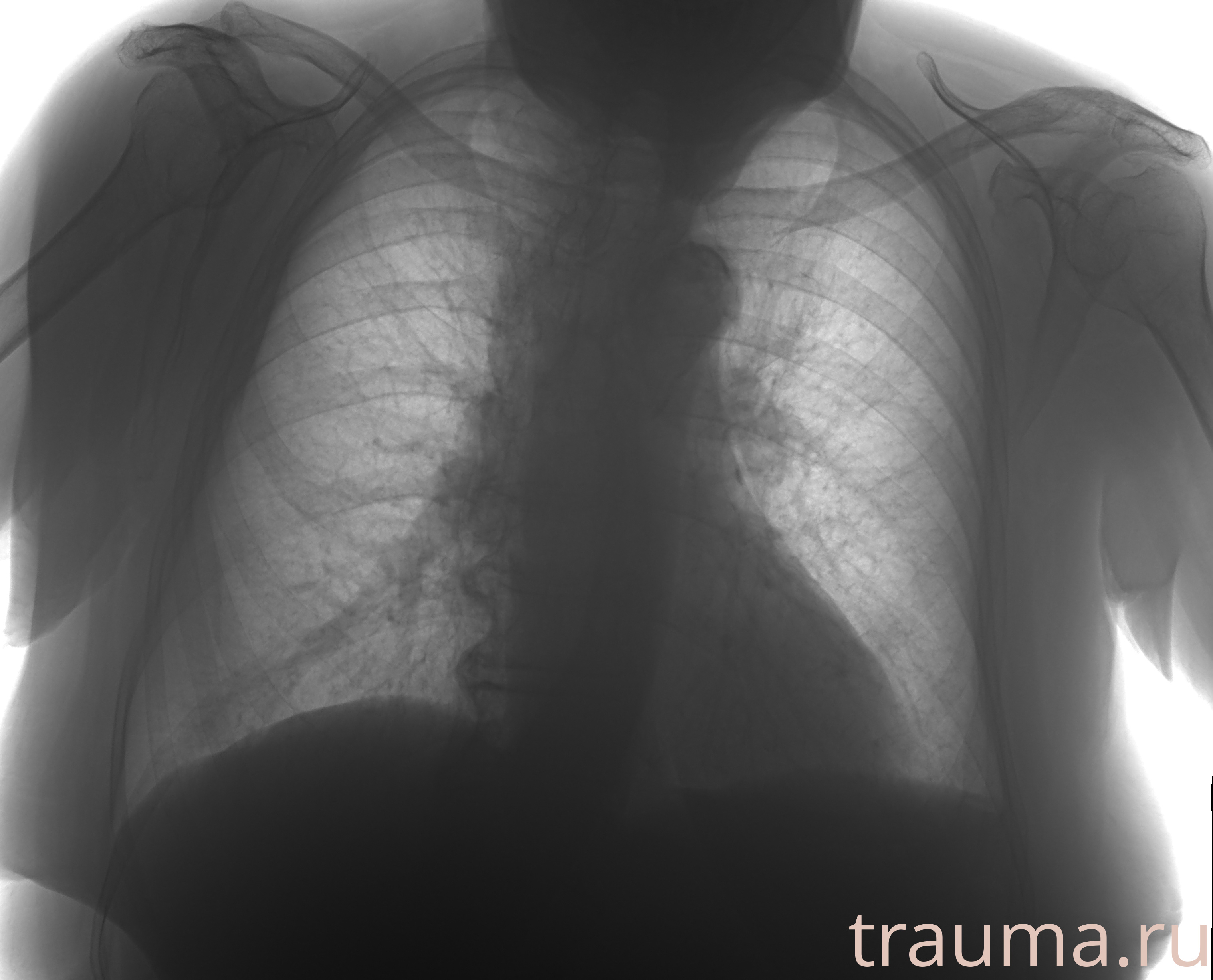 Рентген на дому: по вашему адресу приезжает врач-рентгенолог, травматолог-ортопед с мобильным рентгеновским аппаратом, проводит диагностику травмы или заболевания, делает необходимые рентгенограммы, дает рекомендации по дальнейшему лечению. Получить качественные снимки в домашних условиях возможно благодаря уникальной методике, разработанной МосРентген Центром для института  Склифосовского