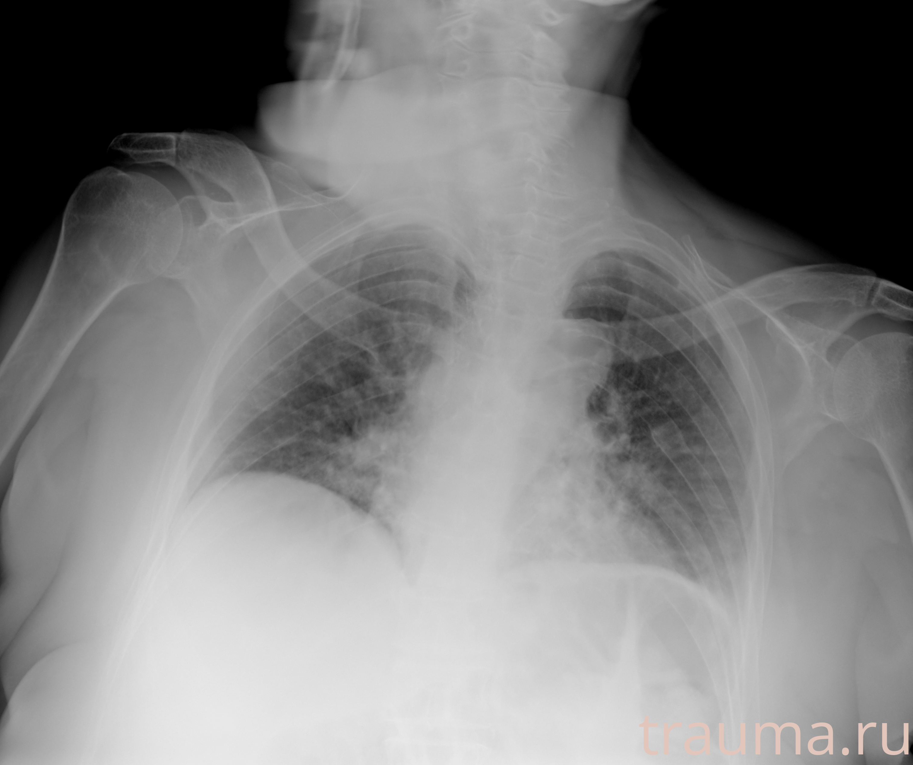 Рентген на дому: по вашему адресу приезжает врач-рентгенолог, травматолог-ортопед с мобильным рентгеновским аппаратом, проводит диагностику травмы или заболевания, делает необходимые рентгенограммы, дает рекомендации по дальнейшему лечению. Получить качественные снимки в домашних условиях возможно благодаря уникальной методике, разработанной МосРентген Центром для института  Склифосовского