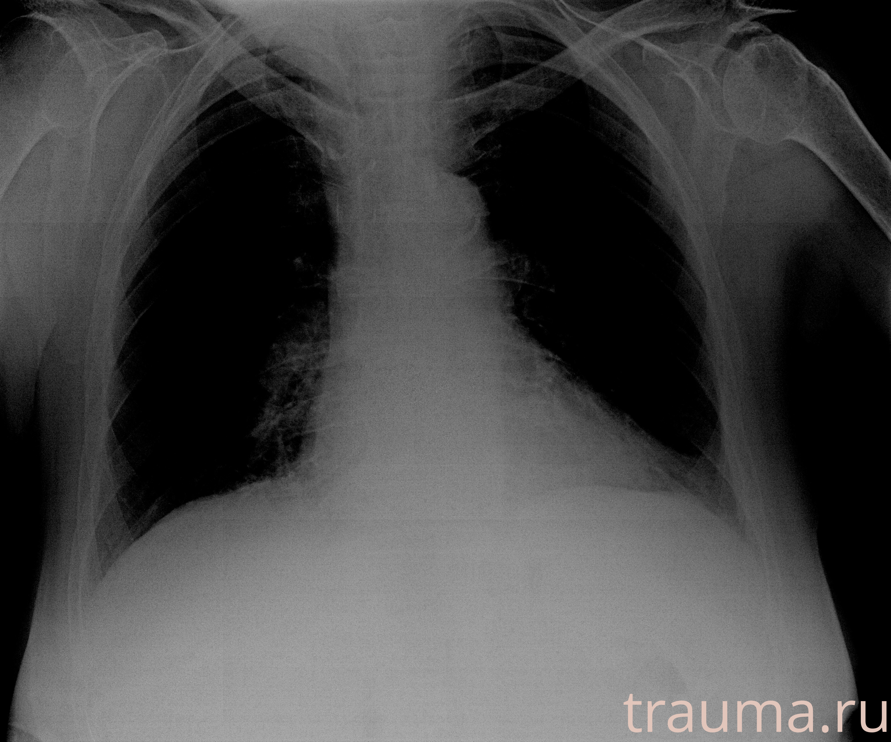 Рентген на дому: по вашему адресу приезжает врач-рентгенолог, травматолог-ортопед с мобильным рентгеновским аппаратом, проводит диагностику травмы или заболевания, делает необходимые рентгенограммы, дает рекомендации по дальнейшему лечению. Получить качественные снимки в домашних условиях возможно благодаря уникальной методике, разработанной МосРентген Центром для института  Склифосовского