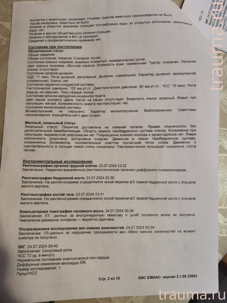 Рентген на дому: по вашему адресу приезжает врач-рентгенолог, травматолог-ортопед с мобильным рентгеновским аппаратом, проводит диагностику травмы или заболевания, делает необходимые рентгенограммы, дает рекомендации по дальнейшему лечению. Получить качественные снимки в домашних условиях возможно благодаря уникальной методике, разработанной МосРентген Центром для института  Склифосовского