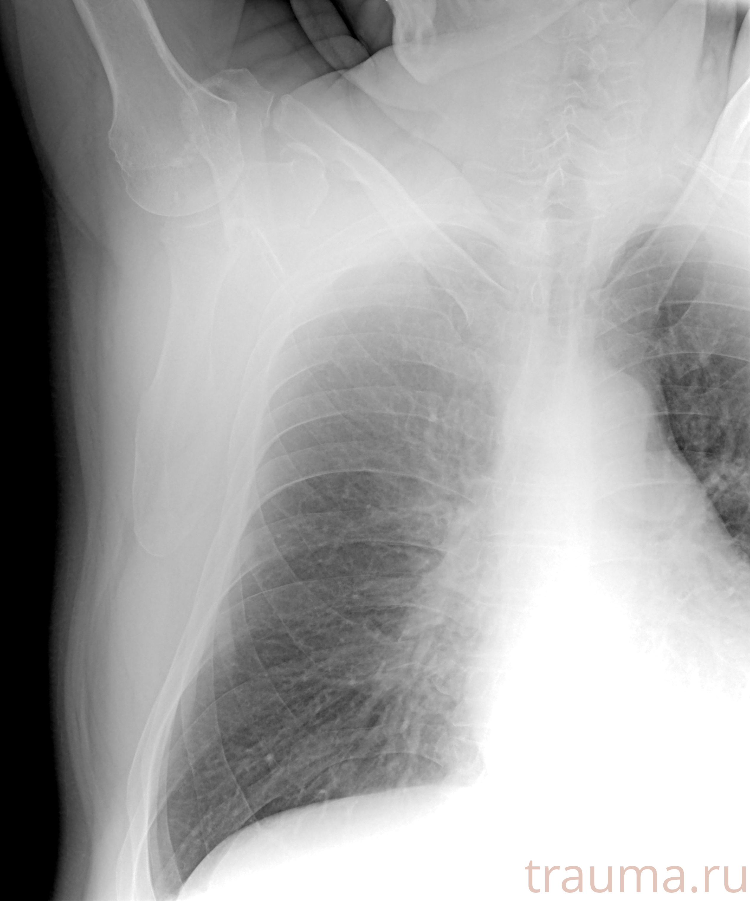 Рентген на дому: по вашему адресу приезжает врач-рентгенолог, травматолог-ортопед с мобильным рентгеновским аппаратом, проводит диагностику травмы или заболевания, делает необходимые рентгенограммы, дает рекомендации по дальнейшему лечению. Получить качественные снимки в домашних условиях возможно благодаря уникальной методике, разработанной МосРентген Центром для института  Склифосовского