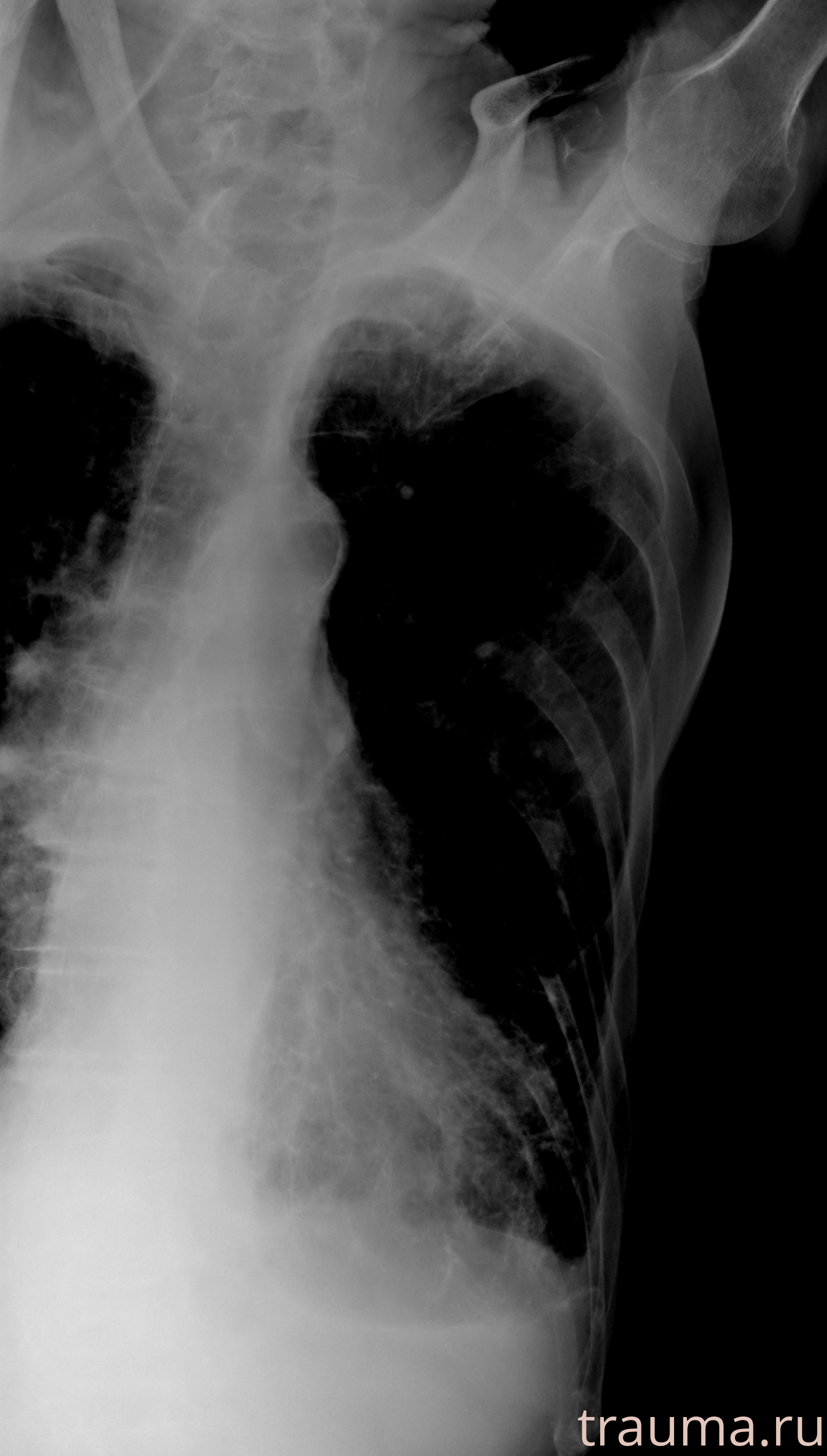 Рентген на дому: по вашему адресу приезжает врач-рентгенолог, травматолог-ортопед с мобильным рентгеновским аппаратом, проводит диагностику травмы или заболевания, делает необходимые рентгенограммы, дает рекомендации по дальнейшему лечению. Получить качественные снимки в домашних условиях возможно благодаря уникальной методике, разработанной МосРентген Центром для института  Склифосовского