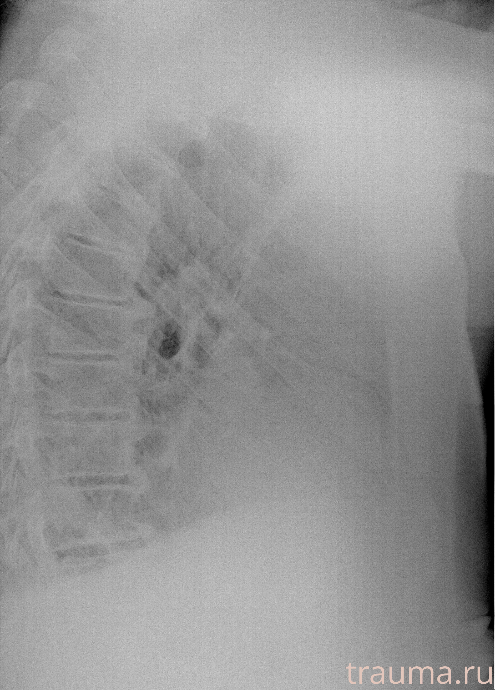 Рентген на дому: по вашему адресу приезжает врач-рентгенолог, травматолог-ортопед с мобильным рентгеновским аппаратом, проводит диагностику травмы или заболевания, делает необходимые рентгенограммы, дает рекомендации по дальнейшему лечению. Получить качественные снимки в домашних условиях возможно благодаря уникальной методике, разработанной МосРентген Центром для института  Склифосовского