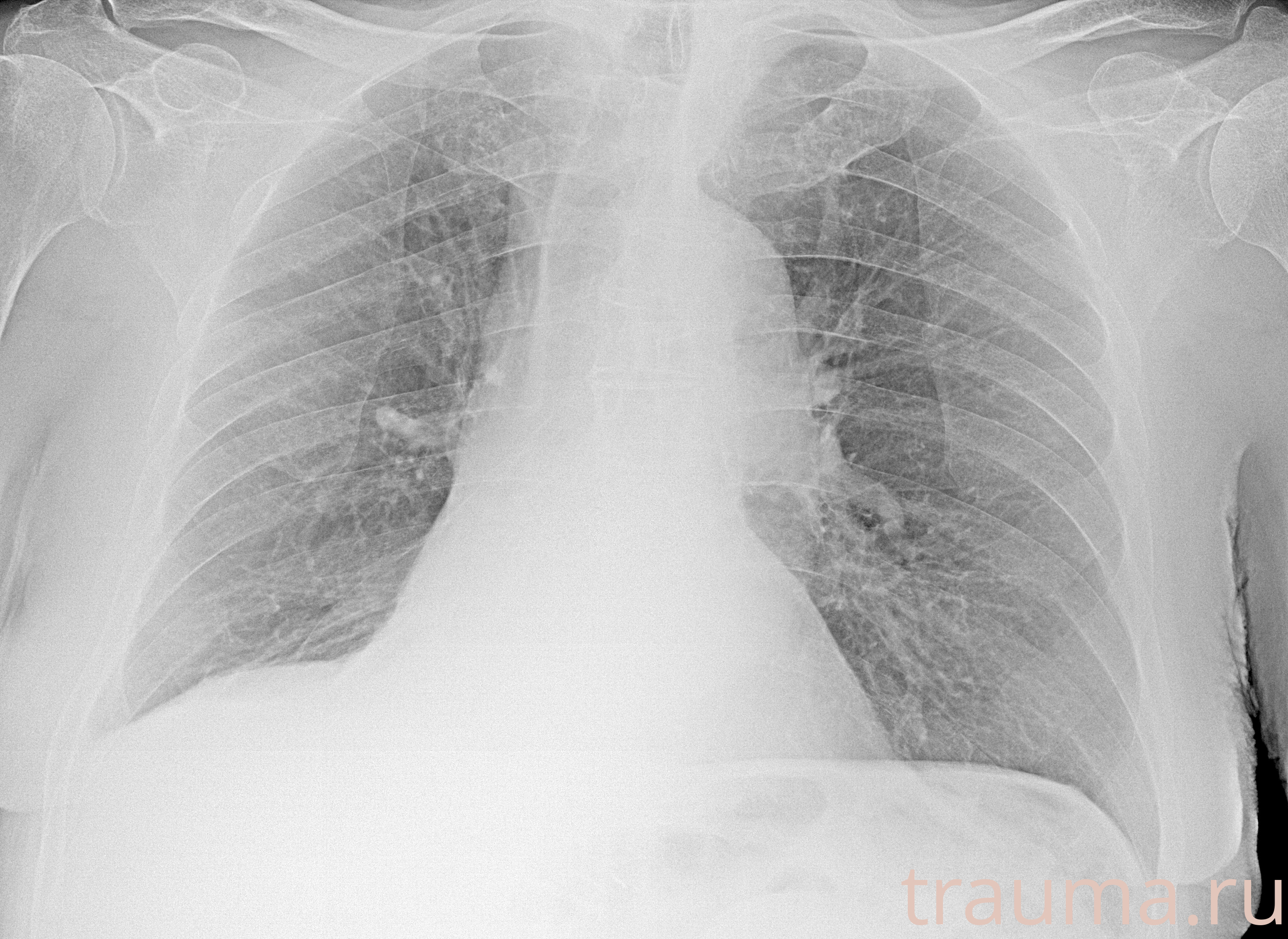 Рентген на дому: по вашему адресу приезжает врач-рентгенолог, травматолог-ортопед с мобильным рентгеновским аппаратом, проводит диагностику травмы или заболевания, делает необходимые рентгенограммы, дает рекомендации по дальнейшему лечению. Получить качественные снимки в домашних условиях возможно благодаря уникальной методике, разработанной МосРентген Центром для института  Склифосовского