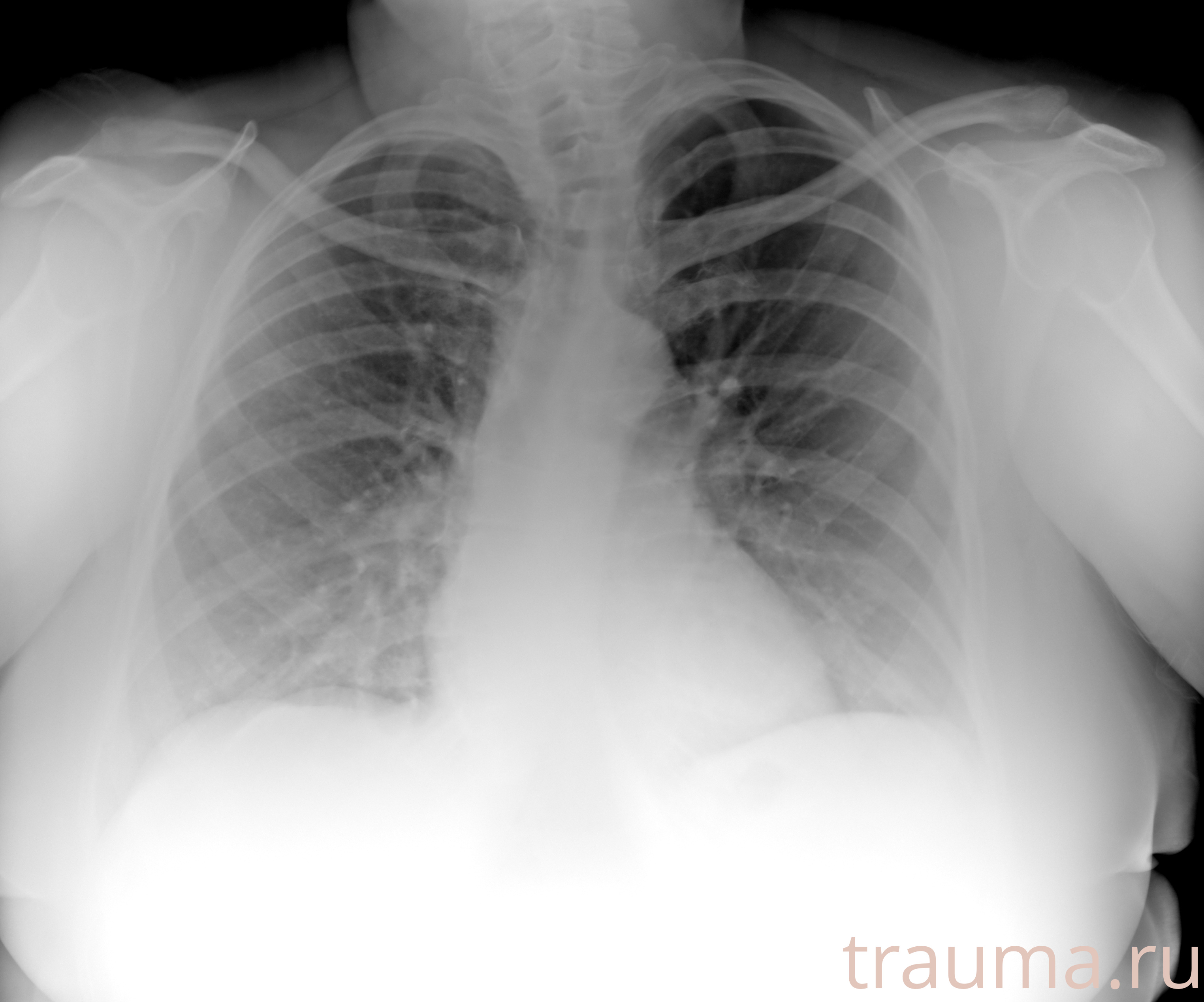 Рентген на дому: по вашему адресу приезжает врач-рентгенолог, травматолог-ортопед с мобильным рентгеновским аппаратом, проводит диагностику травмы или заболевания, делает необходимые рентгенограммы, дает рекомендации по дальнейшему лечению. Получить качественные снимки в домашних условиях возможно благодаря уникальной методике, разработанной МосРентген Центром для института  Склифосовского