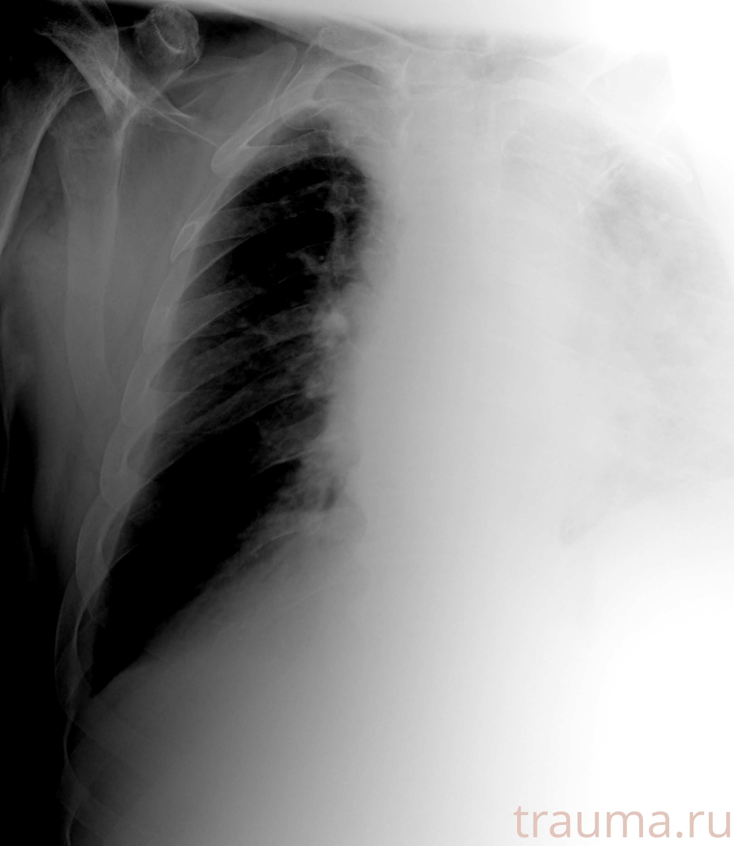 Рентген на дому: по вашему адресу приезжает врач-рентгенолог, травматолог-ортопед с мобильным рентгеновским аппаратом, проводит диагностику травмы или заболевания, делает необходимые рентгенограммы, дает рекомендации по дальнейшему лечению. Получить качественные снимки в домашних условиях возможно благодаря уникальной методике, разработанной МосРентген Центром для института  Склифосовского