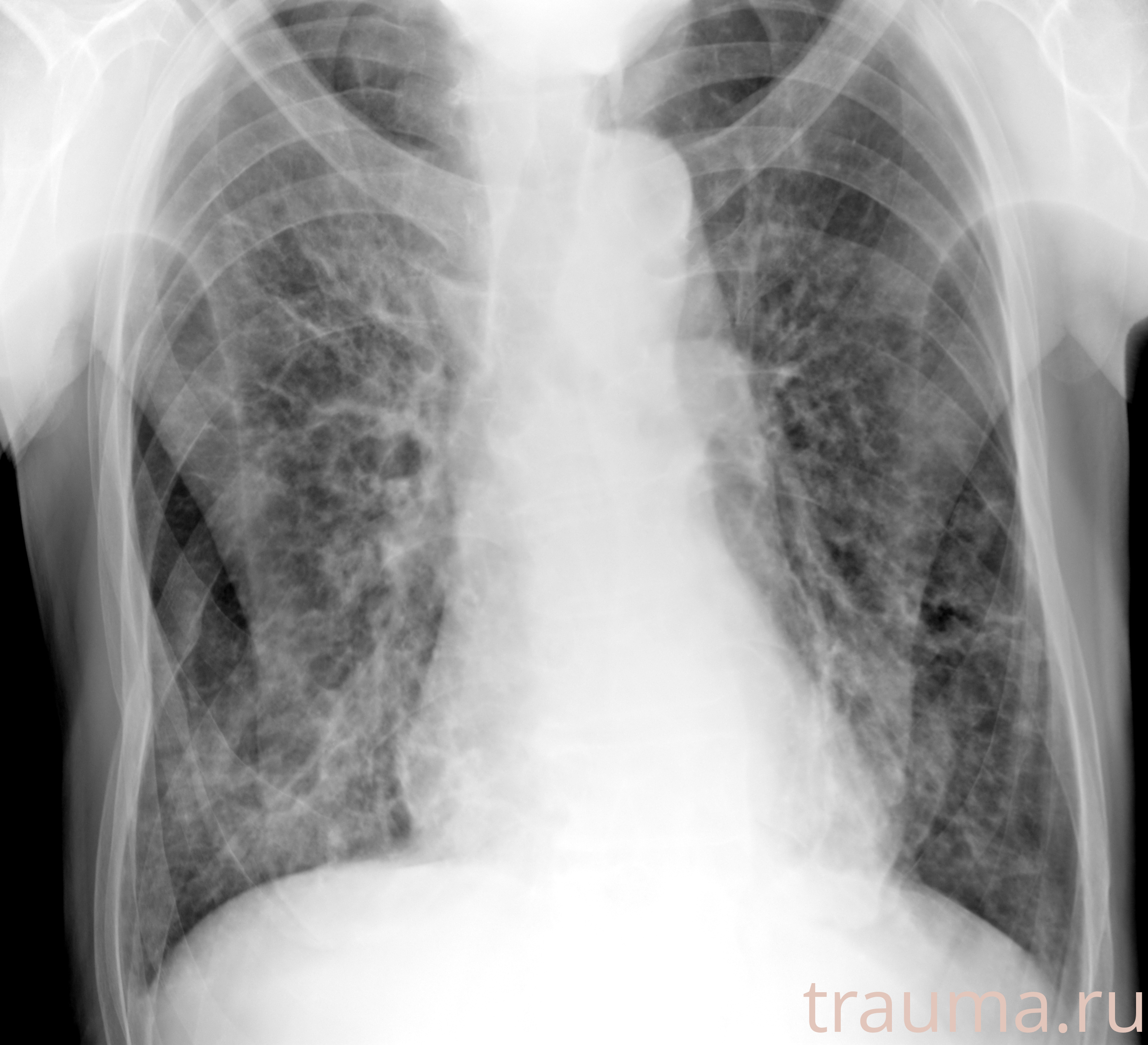 Рентген на дому: по вашему адресу приезжает врач-рентгенолог, травматолог-ортопед с мобильным рентгеновским аппаратом, проводит диагностику травмы или заболевания, делает необходимые рентгенограммы, дает рекомендации по дальнейшему лечению. Получить качественные снимки в домашних условиях возможно благодаря уникальной методике, разработанной МосРентген Центром для института  Склифосовского