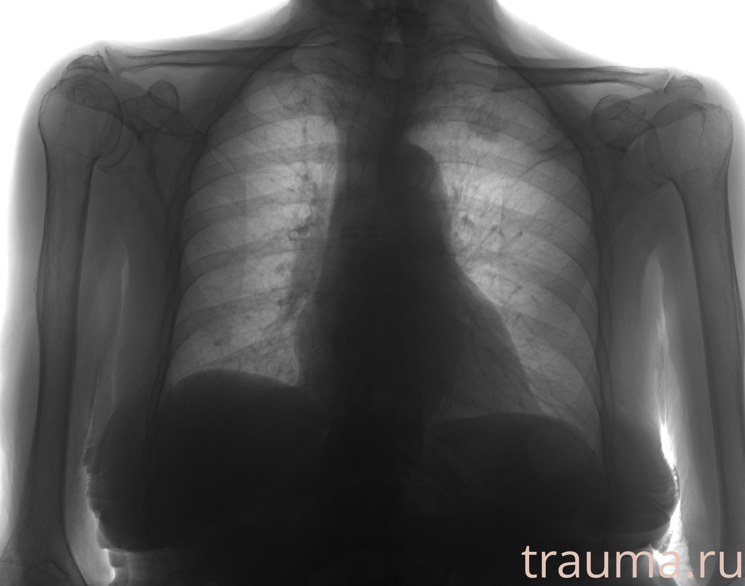 Рентген на дому: по вашему адресу приезжает врач-рентгенолог, травматолог-ортопед с мобильным рентгеновским аппаратом, проводит диагностику травмы или заболевания, делает необходимые рентгенограммы, дает рекомендации по дальнейшему лечению. Получить качественные снимки в домашних условиях возможно благодаря уникальной методике, разработанной МосРентген Центром для института  Склифосовского