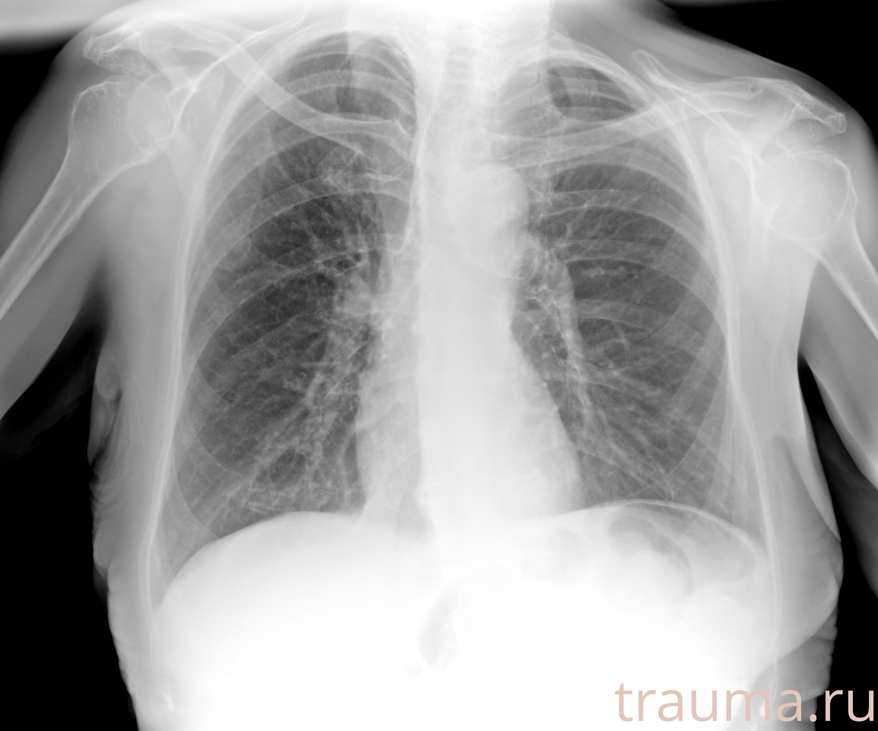 Рентген на дому: по вашему адресу приезжает врач-рентгенолог, травматолог-ортопед с мобильным рентгеновским аппаратом, проводит диагностику травмы или заболевания, делает необходимые рентгенограммы, дает рекомендации по дальнейшему лечению. Получить качественные снимки в домашних условиях возможно благодаря уникальной методике, разработанной МосРентген Центром для института  Склифосовского