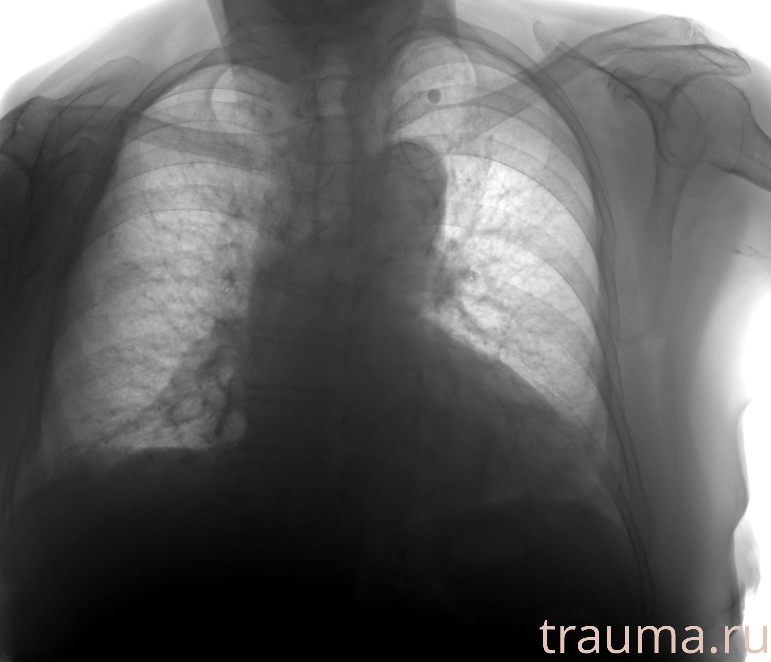 Рентген на дому: по вашему адресу приезжает врач-рентгенолог, травматолог-ортопед с мобильным рентгеновским аппаратом, проводит диагностику травмы или заболевания, делает необходимые рентгенограммы, дает рекомендации по дальнейшему лечению. Получить качественные снимки в домашних условиях возможно благодаря уникальной методике, разработанной МосРентген Центром для института  Склифосовского
