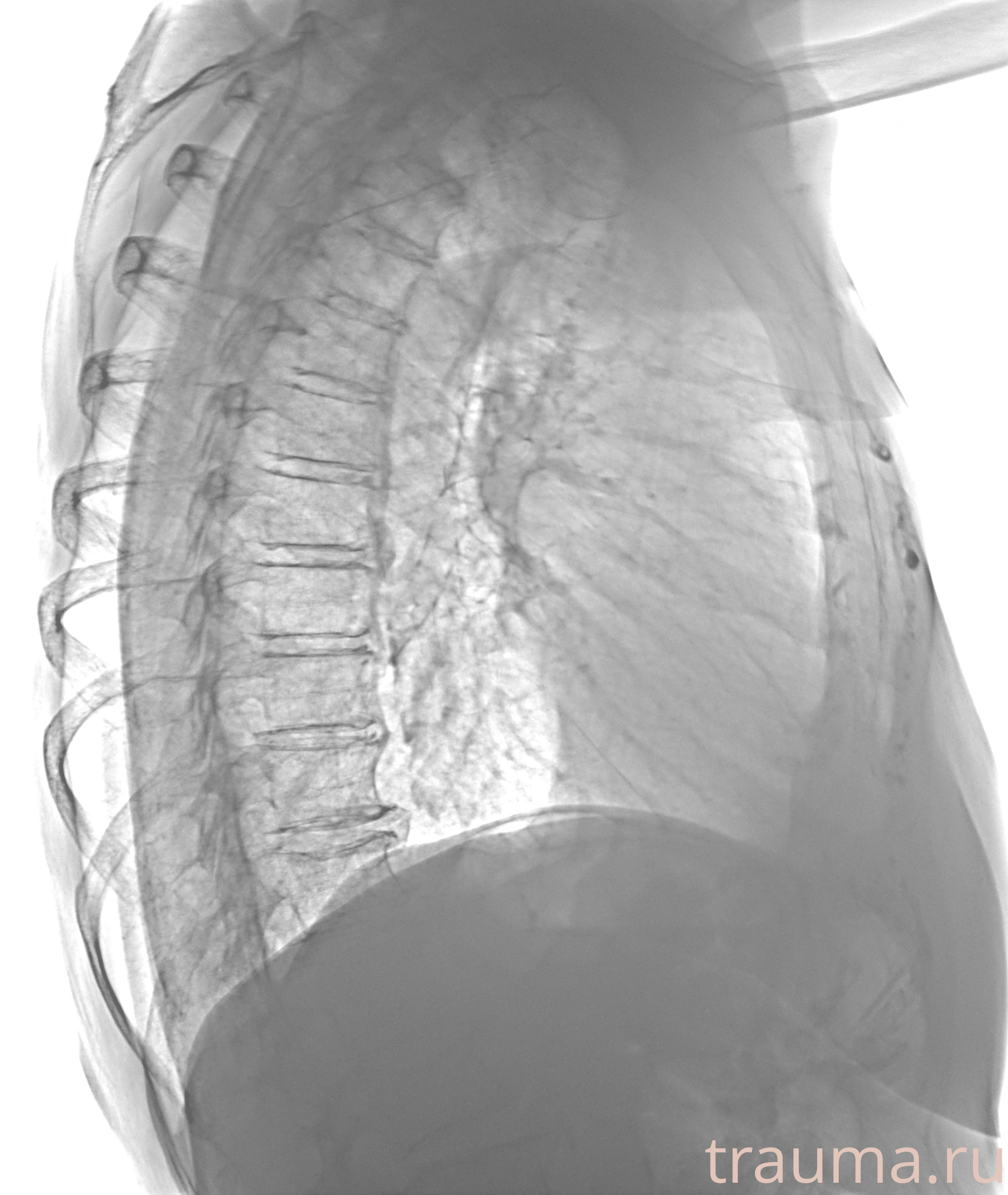 Рентген на дому: по вашему адресу приезжает врач-рентгенолог, травматолог-ортопед с мобильным рентгеновским аппаратом, проводит диагностику травмы или заболевания, делает необходимые рентгенограммы, дает рекомендации по дальнейшему лечению. Получить качественные снимки в домашних условиях возможно благодаря уникальной методике, разработанной МосРентген Центром для института  Склифосовского