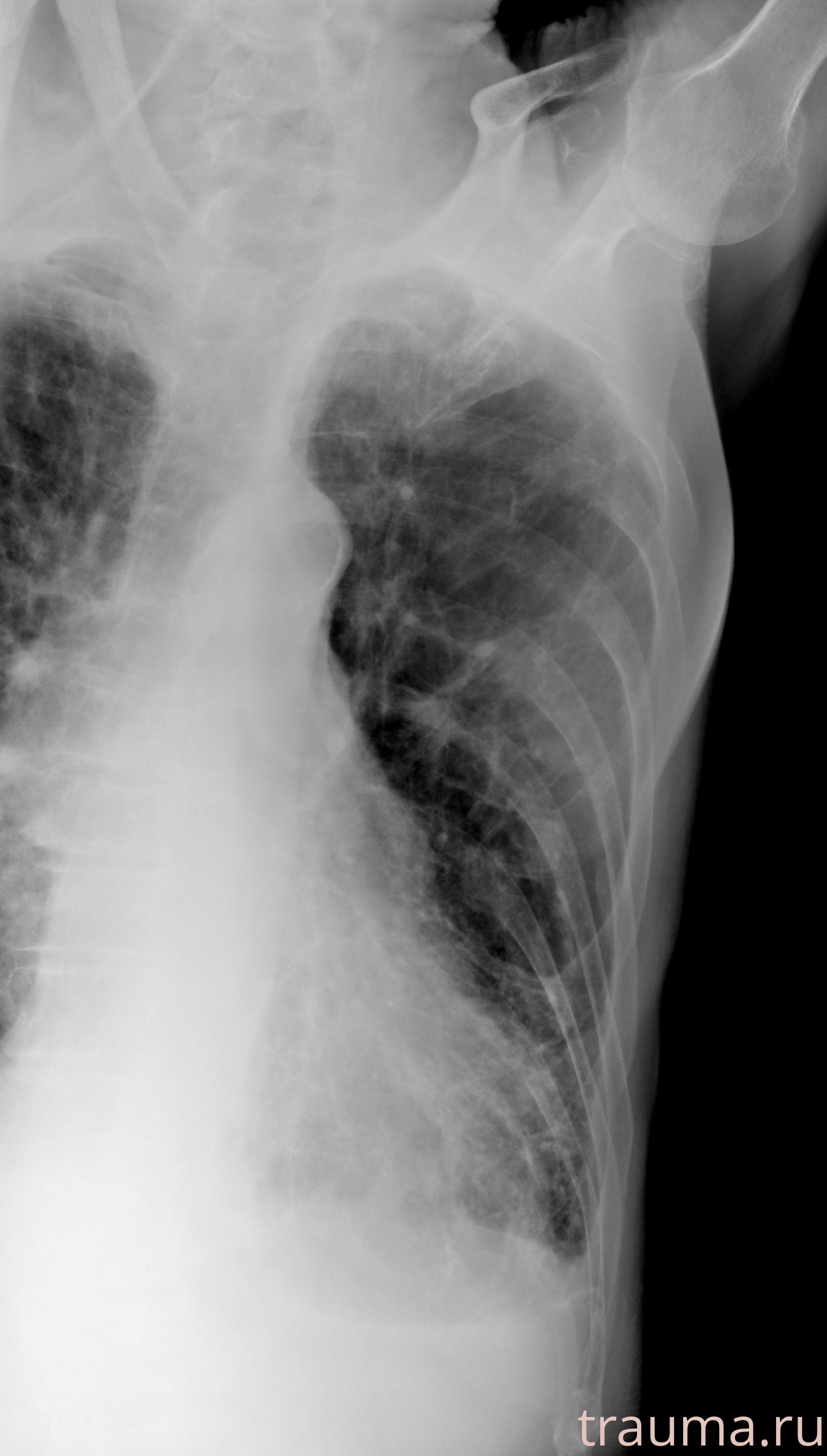 Рентген на дому: по вашему адресу приезжает врач-рентгенолог, травматолог-ортопед с мобильным рентгеновским аппаратом, проводит диагностику травмы или заболевания, делает необходимые рентгенограммы, дает рекомендации по дальнейшему лечению. Получить качественные снимки в домашних условиях возможно благодаря уникальной методике, разработанной МосРентген Центром для института  Склифосовского