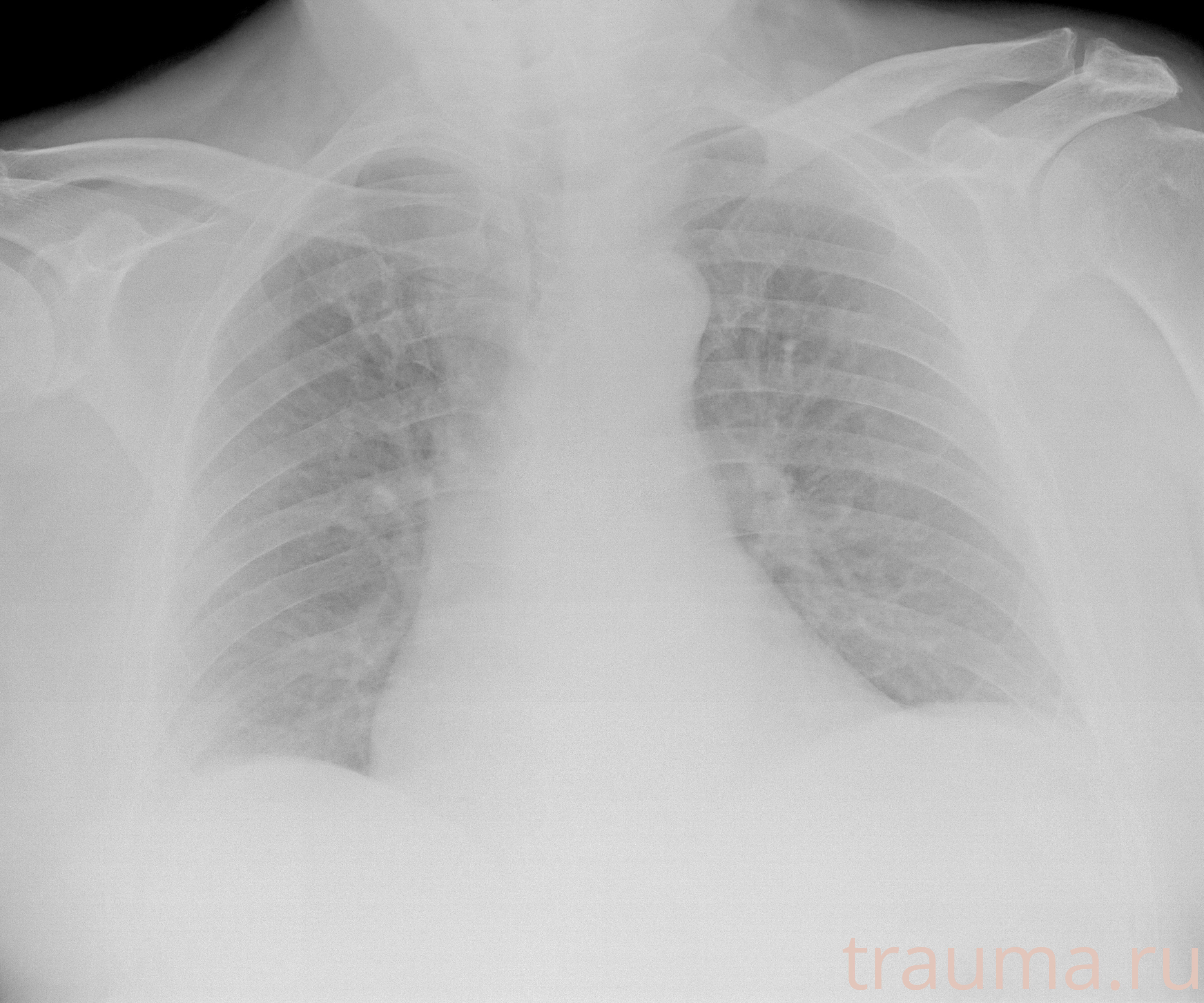 Рентген на дому: по вашему адресу приезжает врач-рентгенолог, травматолог-ортопед с мобильным рентгеновским аппаратом, проводит диагностику травмы или заболевания, делает необходимые рентгенограммы, дает рекомендации по дальнейшему лечению. Получить качественные снимки в домашних условиях возможно благодаря уникальной методике, разработанной МосРентген Центром для института  Склифосовского