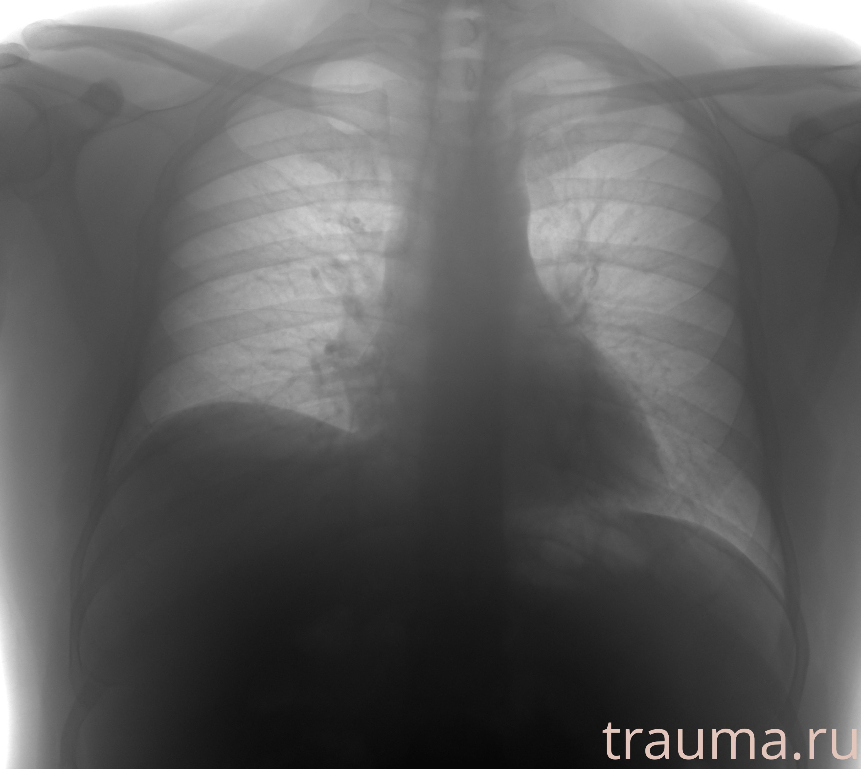 Рентген на дому: по вашему адресу приезжает врач-рентгенолог, травматолог-ортопед с мобильным рентгеновским аппаратом, проводит диагностику травмы или заболевания, делает необходимые рентгенограммы, дает рекомендации по дальнейшему лечению. Получить качественные снимки в домашних условиях возможно благодаря уникальной методике, разработанной МосРентген Центром для института  Склифосовского