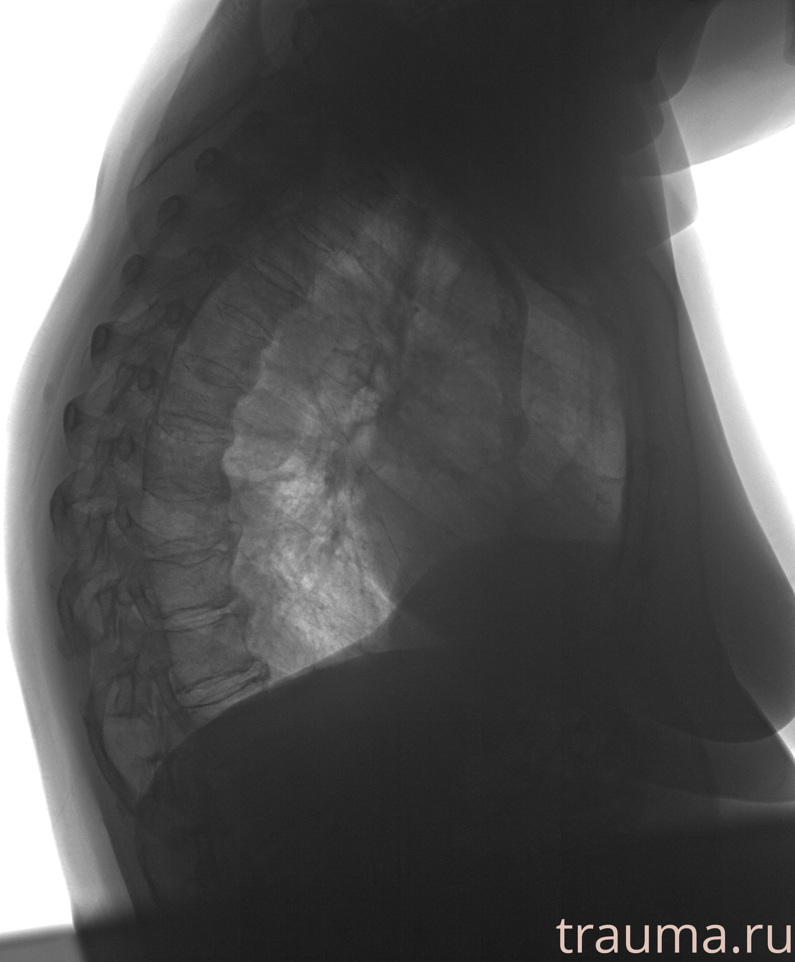 Рентген на дому: по вашему адресу приезжает врач-рентгенолог, травматолог-ортопед с мобильным рентгеновским аппаратом, проводит диагностику травмы или заболевания, делает необходимые рентгенограммы, дает рекомендации по дальнейшему лечению. Получить качественные снимки в домашних условиях возможно благодаря уникальной методике, разработанной МосРентген Центром для института  Склифосовского