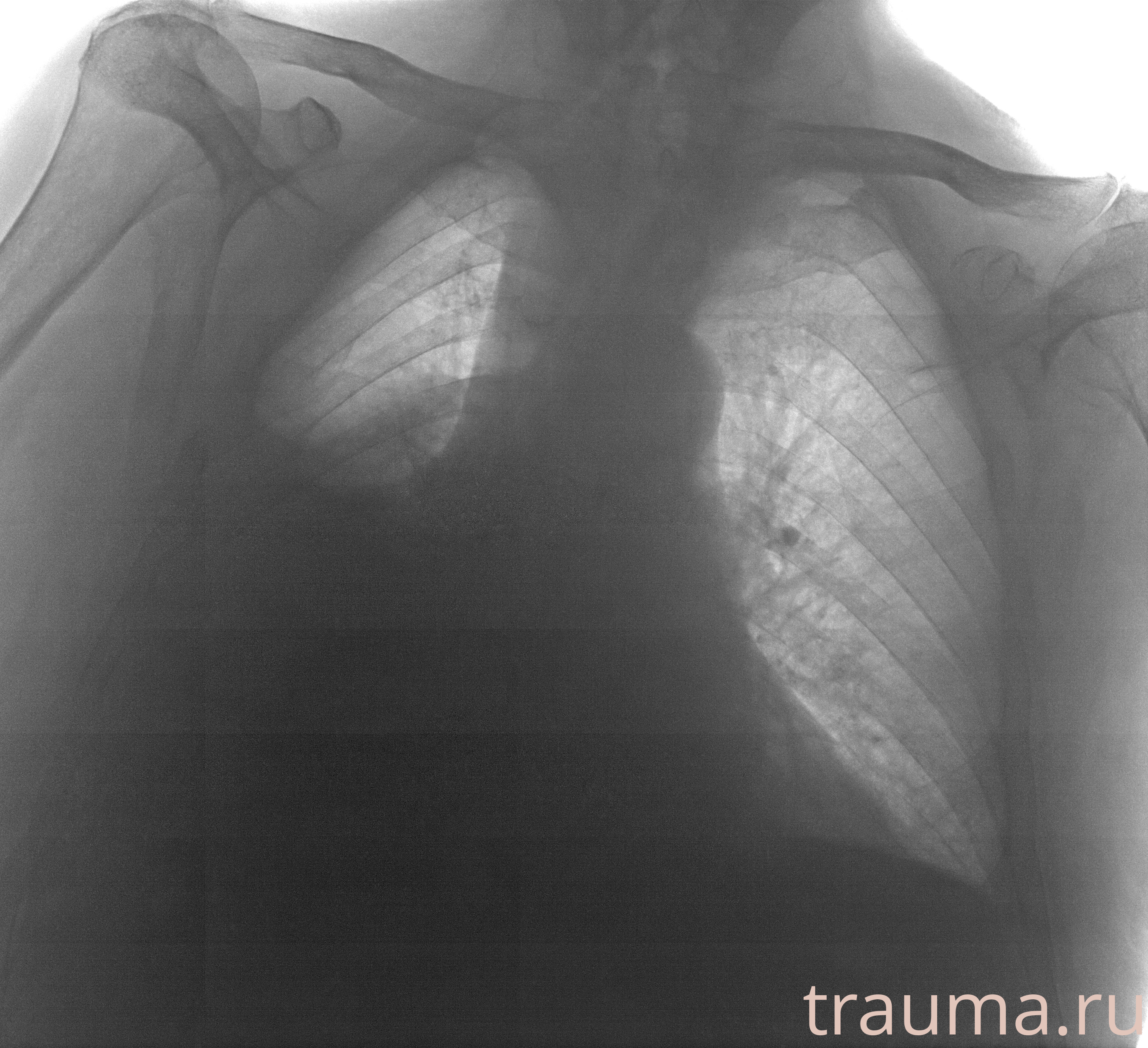 Рентген на дому: по вашему адресу приезжает врач-рентгенолог, травматолог-ортопед с мобильным рентгеновским аппаратом, проводит диагностику травмы или заболевания, делает необходимые рентгенограммы, дает рекомендации по дальнейшему лечению. Получить качественные снимки в домашних условиях возможно благодаря уникальной методике, разработанной МосРентген Центром для института  Склифосовского