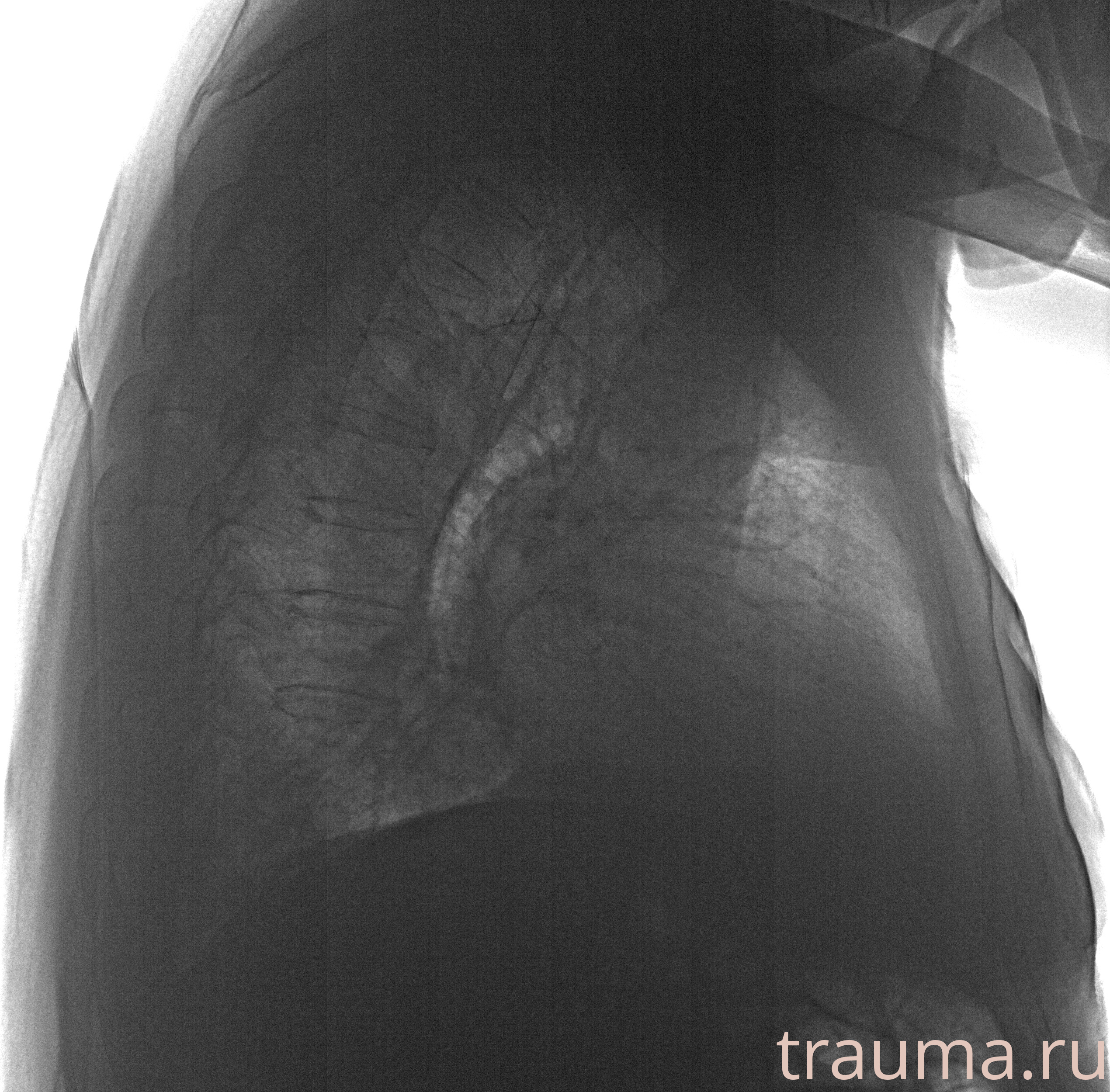 Рентген на дому: по вашему адресу приезжает врач-рентгенолог, травматолог-ортопед с мобильным рентгеновским аппаратом, проводит диагностику травмы или заболевания, делает необходимые рентгенограммы, дает рекомендации по дальнейшему лечению. Получить качественные снимки в домашних условиях возможно благодаря уникальной методике, разработанной МосРентген Центром для института  Склифосовского