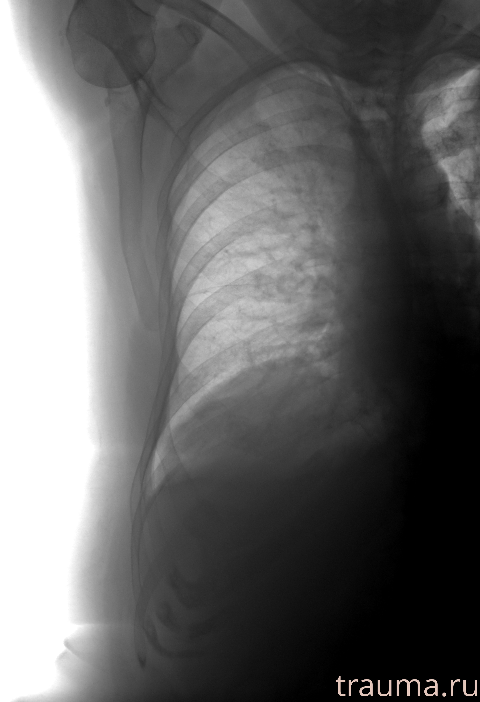 Рентген на дому: по вашему адресу приезжает врач-рентгенолог, травматолог-ортопед с мобильным рентгеновским аппаратом, проводит диагностику травмы или заболевания, делает необходимые рентгенограммы, дает рекомендации по дальнейшему лечению. Получить качественные снимки в домашних условиях возможно благодаря уникальной методике, разработанной МосРентген Центром для института  Склифосовского