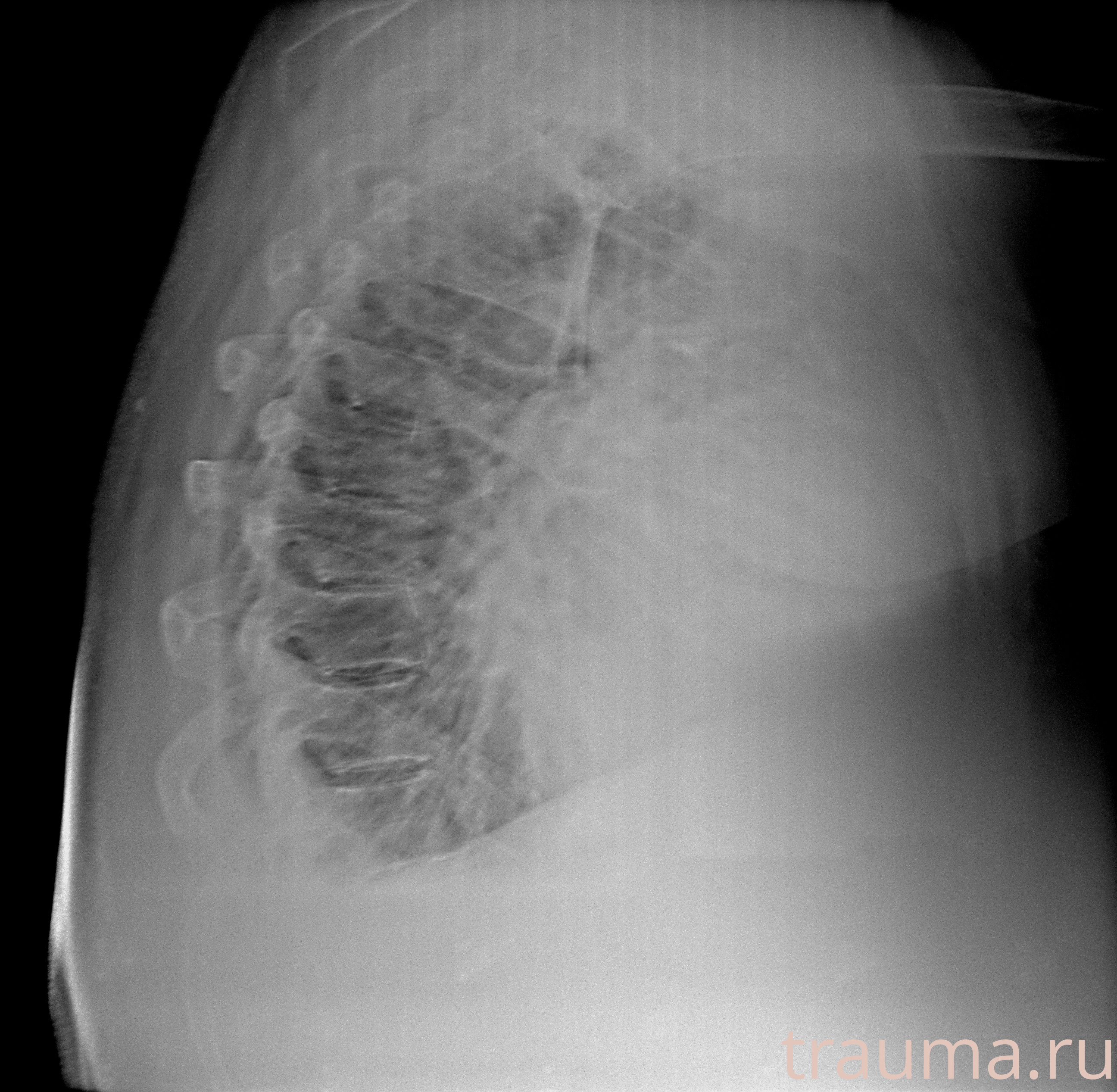 Рентген на дому: по вашему адресу приезжает врач-рентгенолог, травматолог-ортопед с мобильным рентгеновским аппаратом, проводит диагностику травмы или заболевания, делает необходимые рентгенограммы, дает рекомендации по дальнейшему лечению. Получить качественные снимки в домашних условиях возможно благодаря уникальной методике, разработанной МосРентген Центром для института  Склифосовского