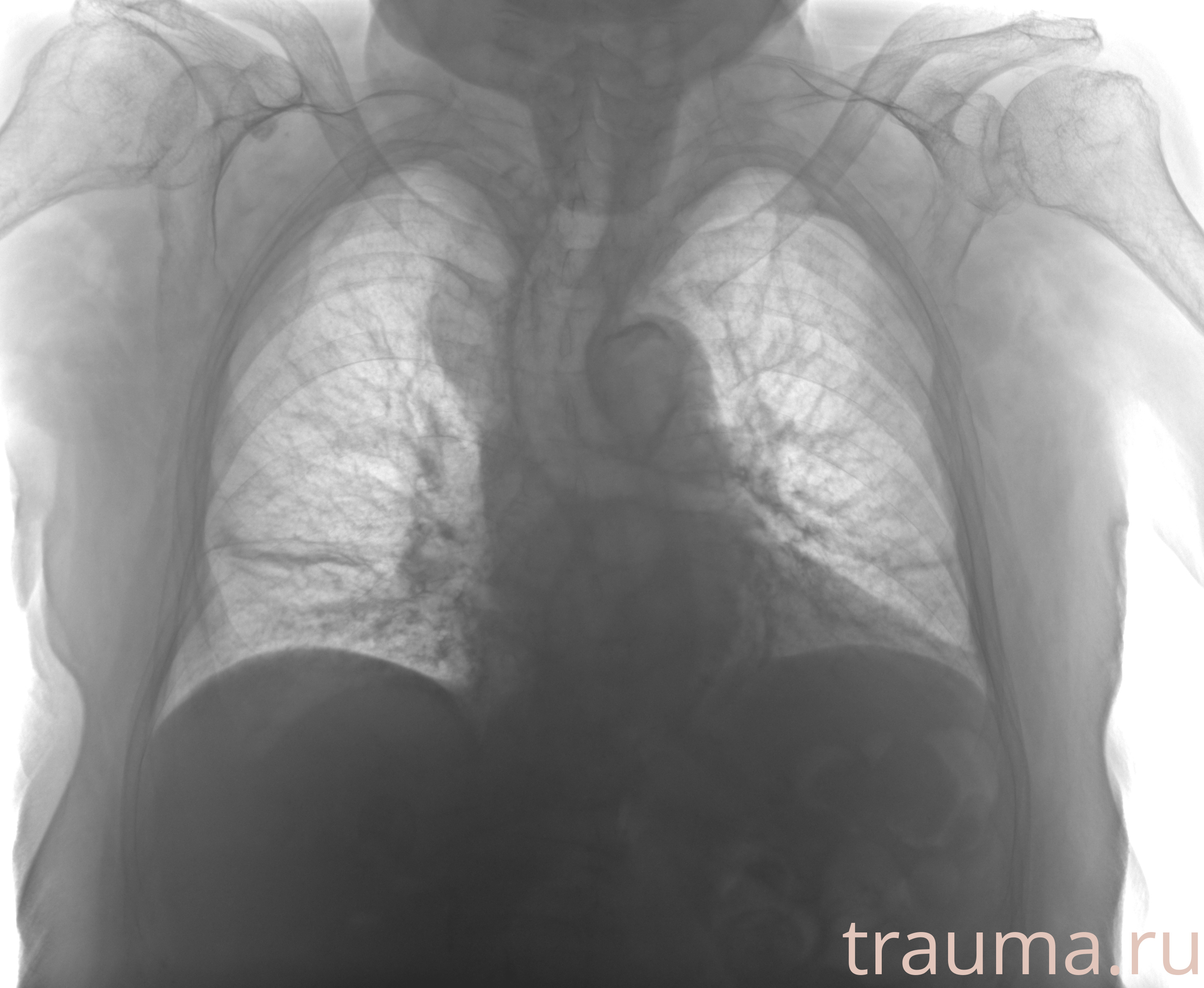 Рентген на дому: по вашему адресу приезжает врач-рентгенолог, травматолог-ортопед с мобильным рентгеновским аппаратом, проводит диагностику травмы или заболевания, делает необходимые рентгенограммы, дает рекомендации по дальнейшему лечению. Получить качественные снимки в домашних условиях возможно благодаря уникальной методике, разработанной МосРентген Центром для института  Склифосовского