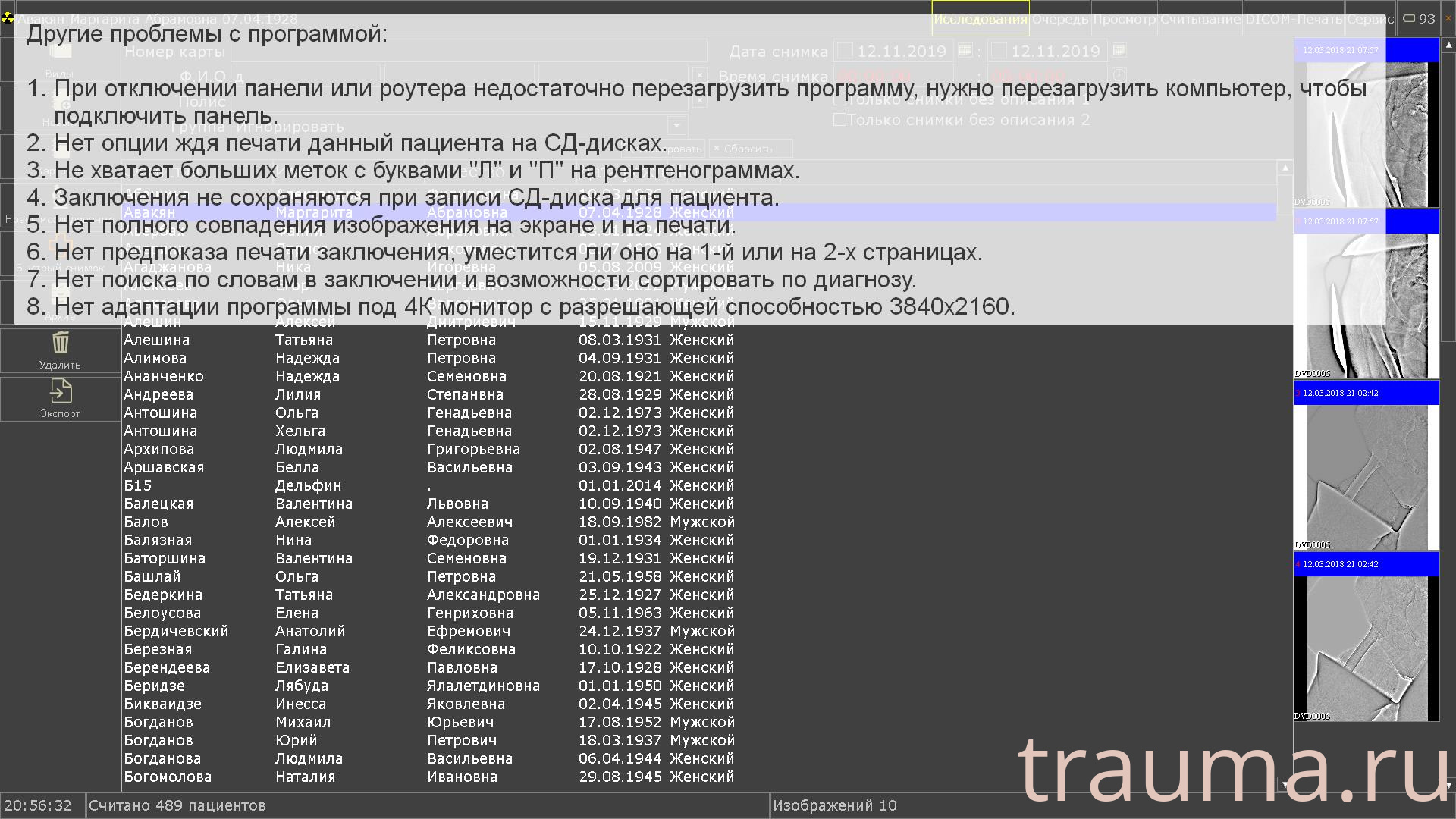 Рентген на дому: по вашему адресу приезжает врач-рентгенолог, травматолог-ортопед с мобильным рентгеновским аппаратом, проводит диагностику травмы или заболевания, делает необходимые рентгенограммы, дает рекомендации по дальнейшему лечению. Получить качественные снимки в домашних условиях возможно благодаря уникальной методике, разработанной МосРентген Центром для института  Склифосовского