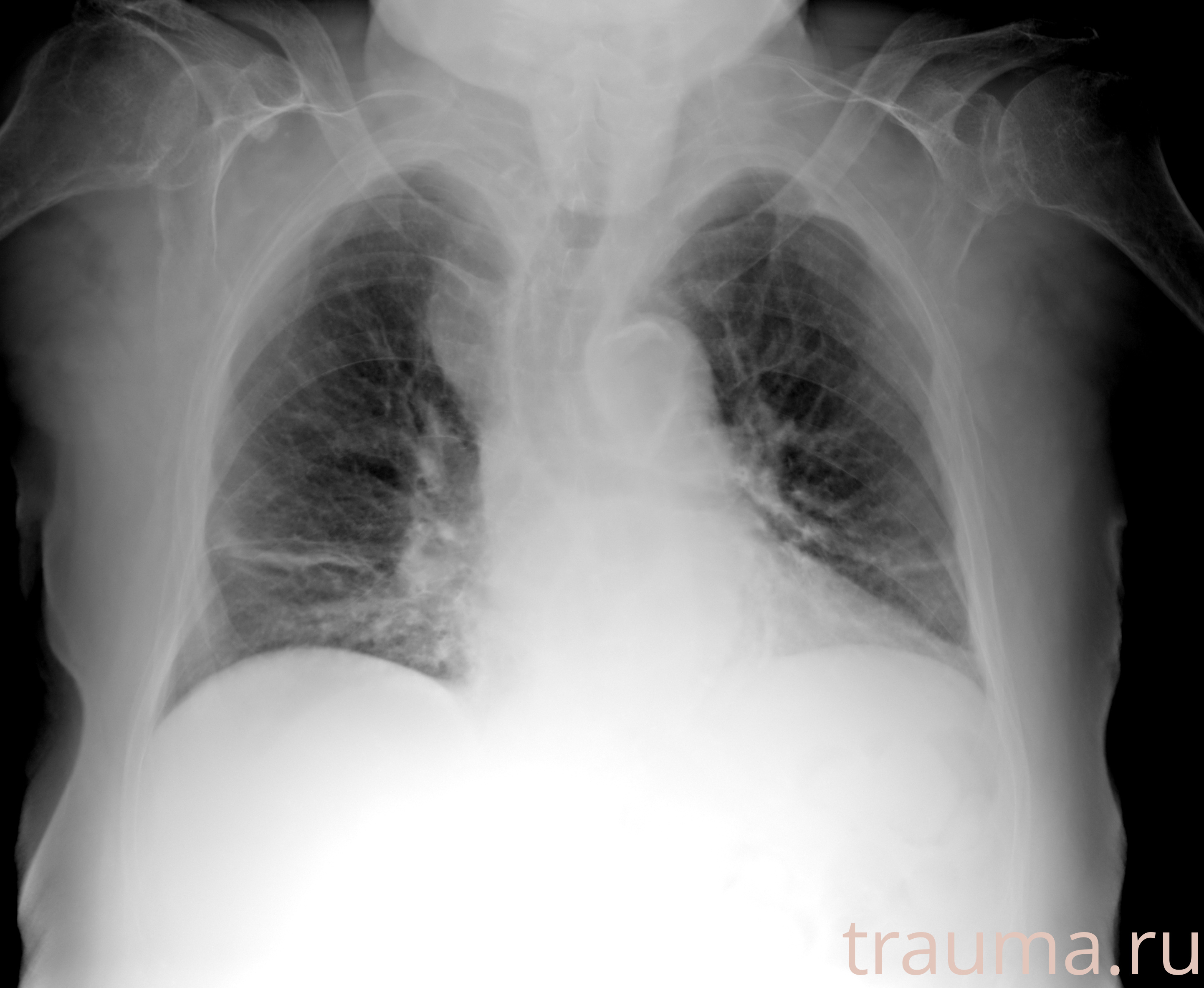 Рентген на дому: по вашему адресу приезжает врач-рентгенолог, травматолог-ортопед с мобильным рентгеновским аппаратом, проводит диагностику травмы или заболевания, делает необходимые рентгенограммы, дает рекомендации по дальнейшему лечению. Получить качественные снимки в домашних условиях возможно благодаря уникальной методике, разработанной МосРентген Центром для института  Склифосовского