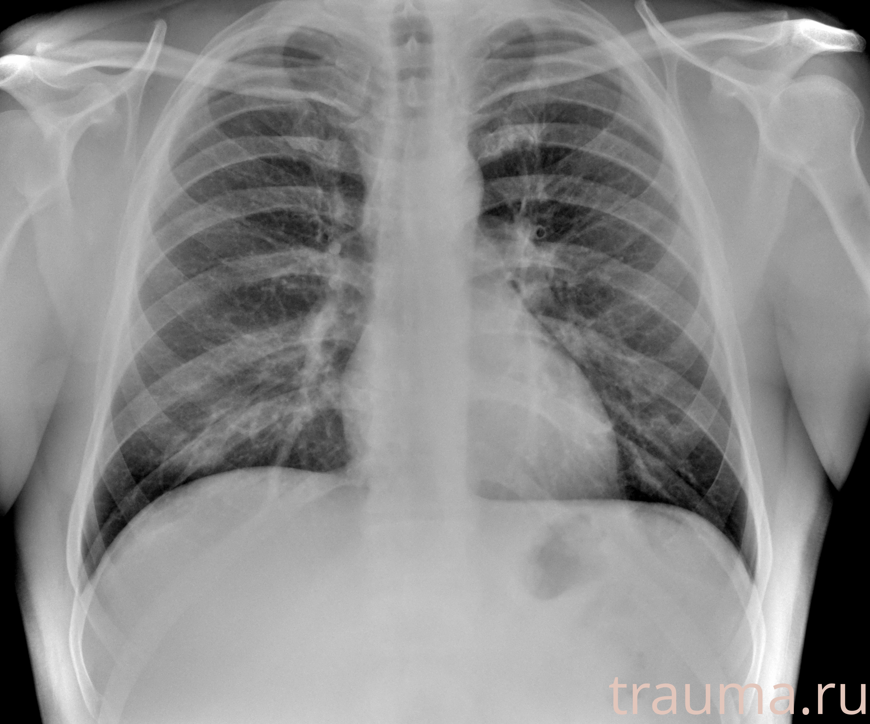 Рентген на дому: по вашему адресу приезжает врач-рентгенолог, травматолог-ортопед с мобильным рентгеновским аппаратом, проводит диагностику травмы или заболевания, делает необходимые рентгенограммы, дает рекомендации по дальнейшему лечению. Получить качественные снимки в домашних условиях возможно благодаря уникальной методике, разработанной МосРентген Центром для института  Склифосовского